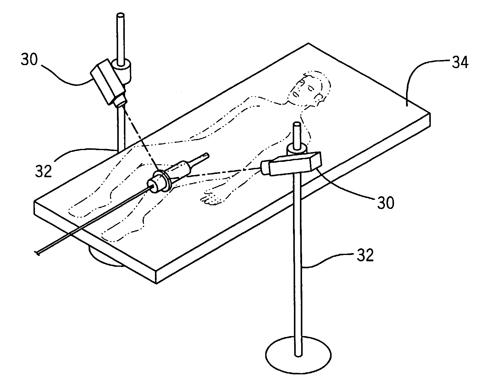Apparatus and method for registration, guidance and targeting of external beam radiation therapy