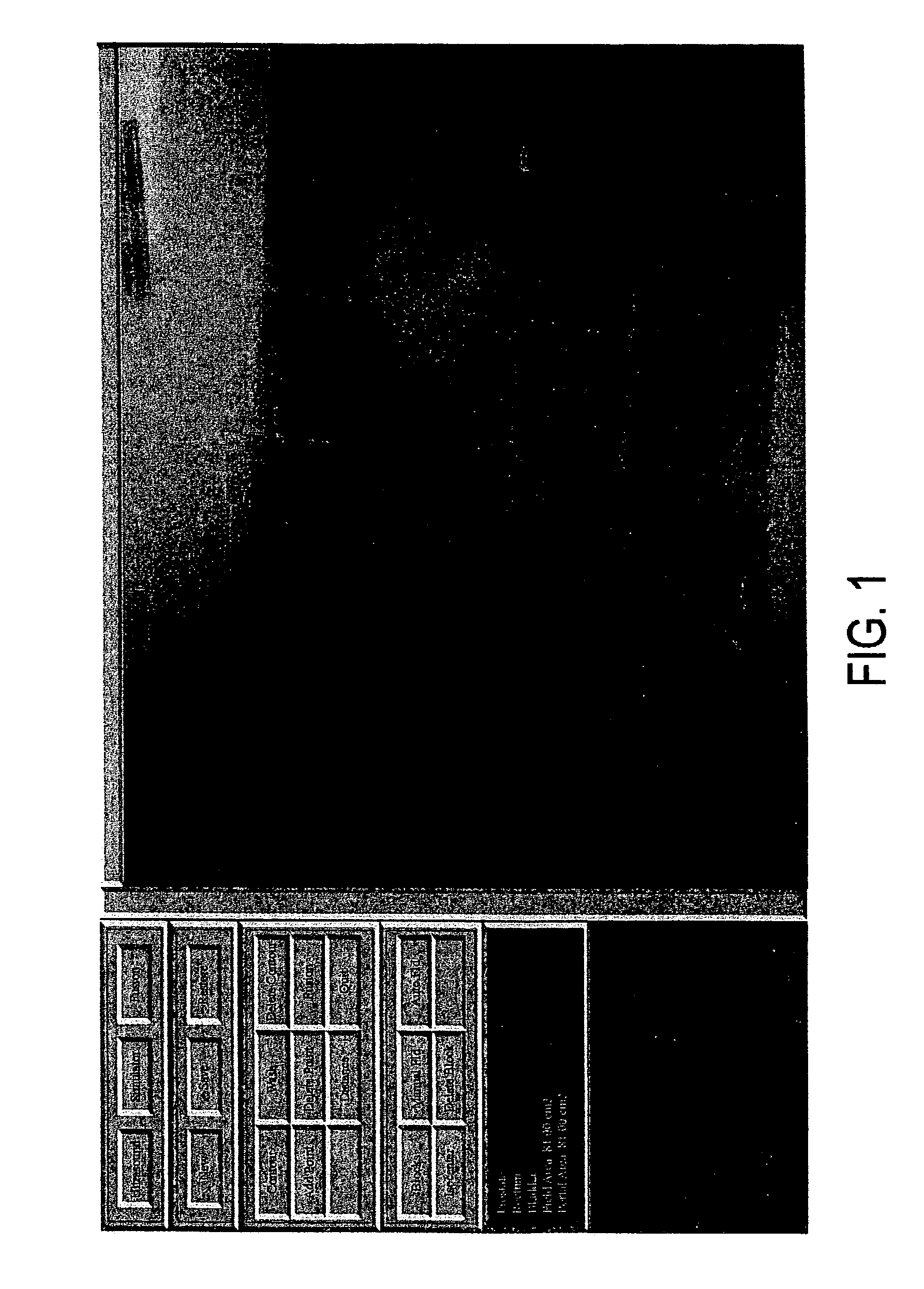 Apparatus and method for registration, guidance and targeting of external beam radiation therapy
