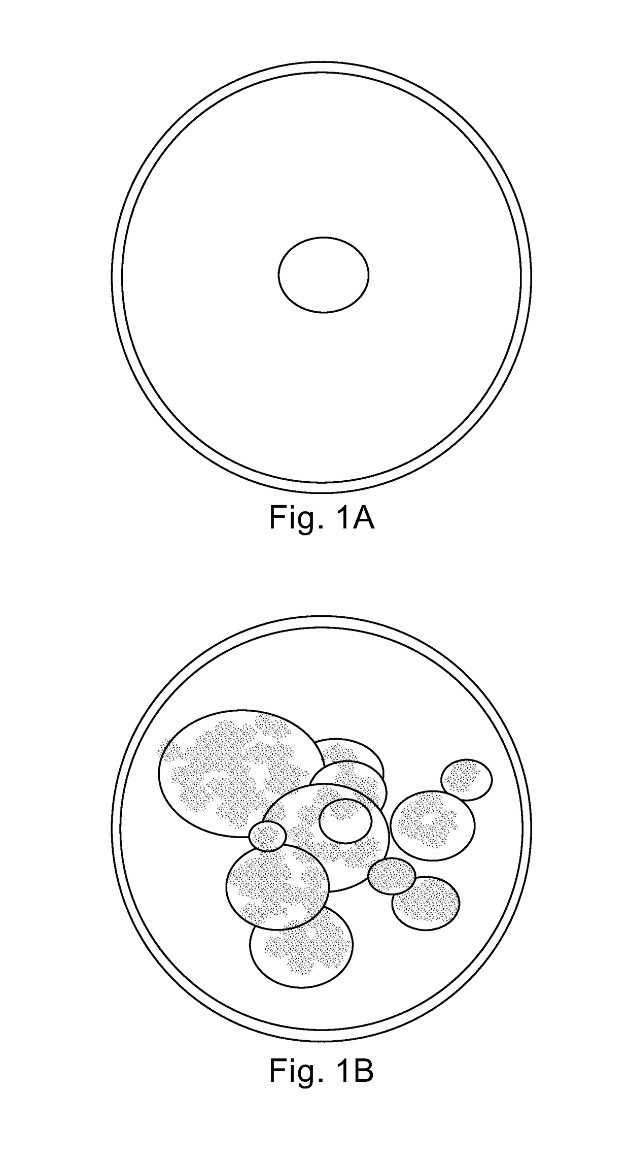 Method and apparatus for tissue disease diagnosis