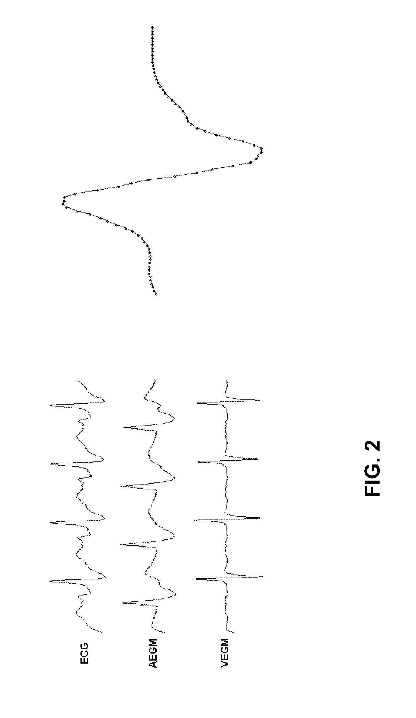 Device, method and computer-readable storage medium for svt and vt classification