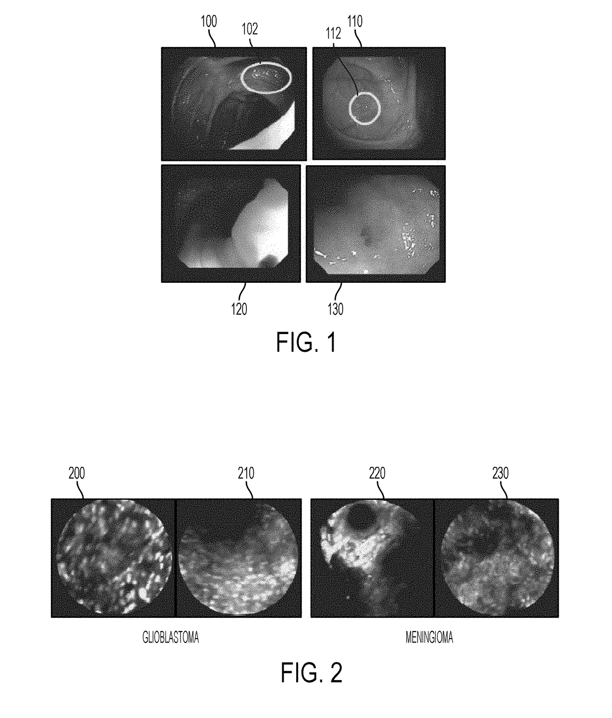 Method and system for classification of endoscopic images using deep decision networks