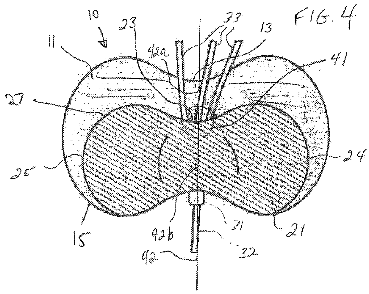 Offset catheter securement device