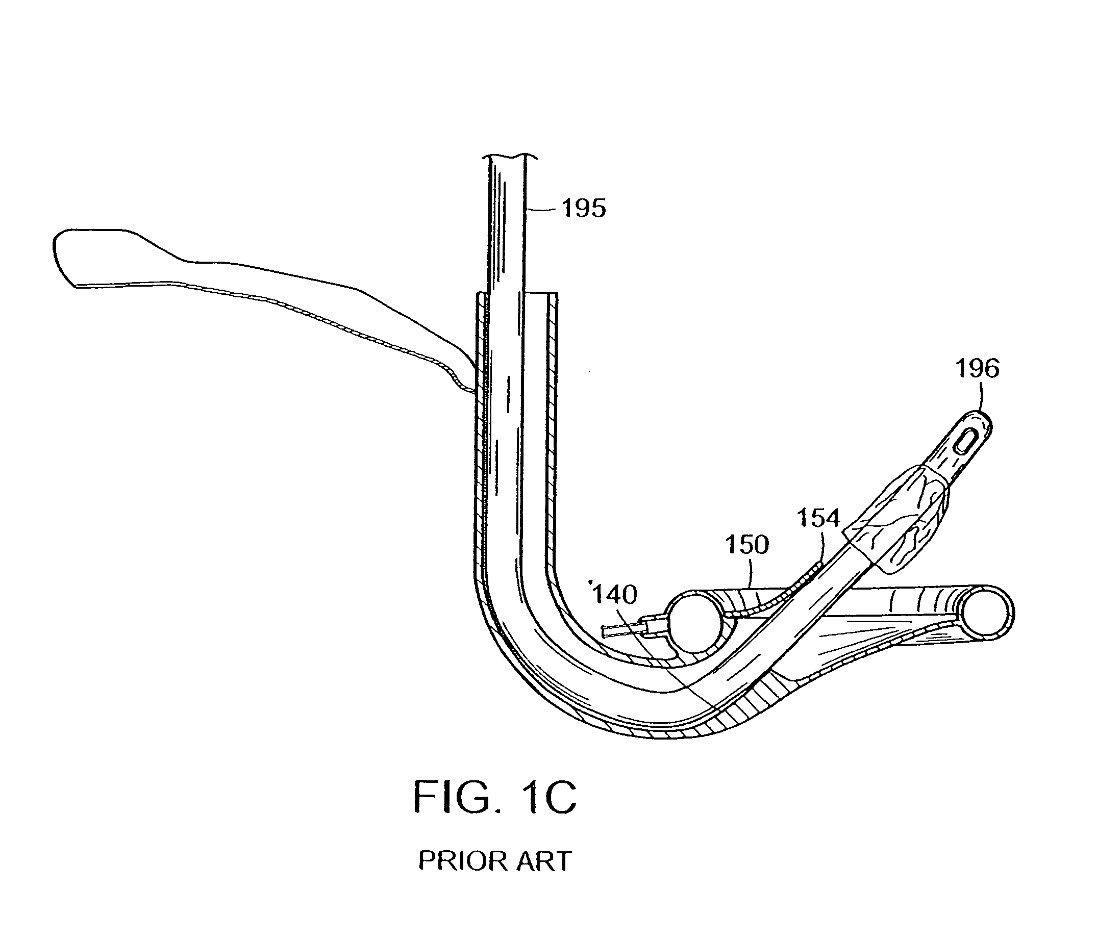 Intubating laryngeal mask airway device with fiber optic assembly