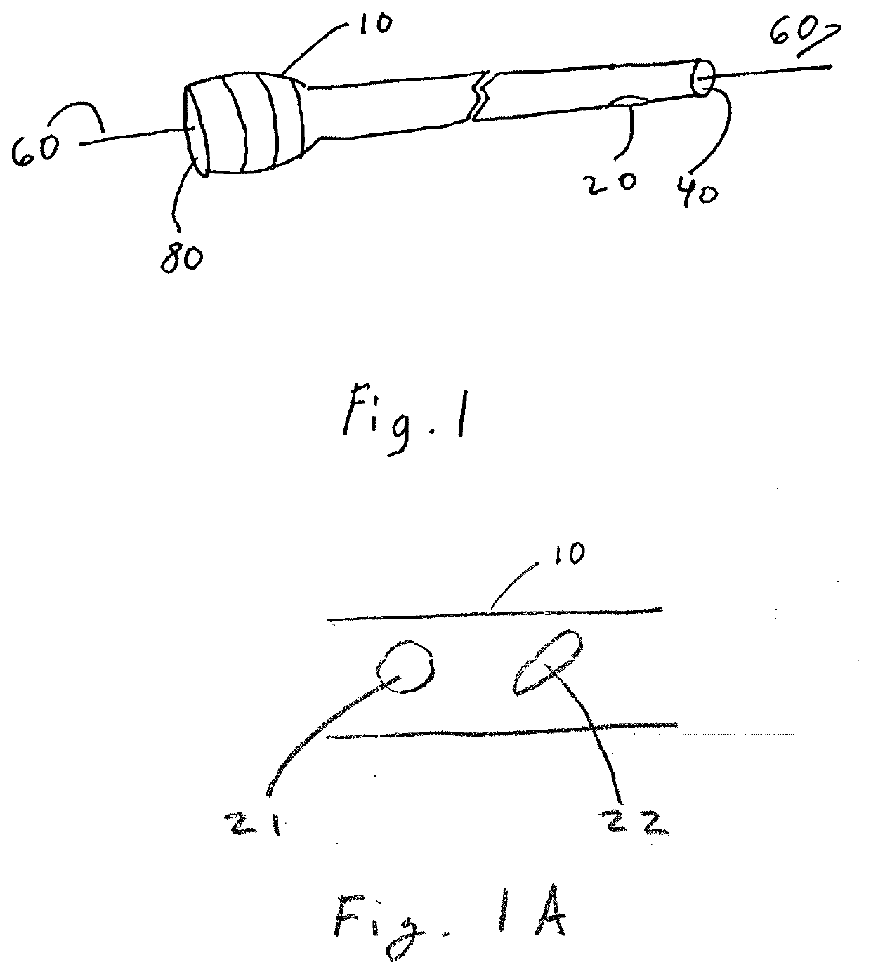 Single Lumen Microcatheter for Executing Plugs near Distal Terminus of Lumen