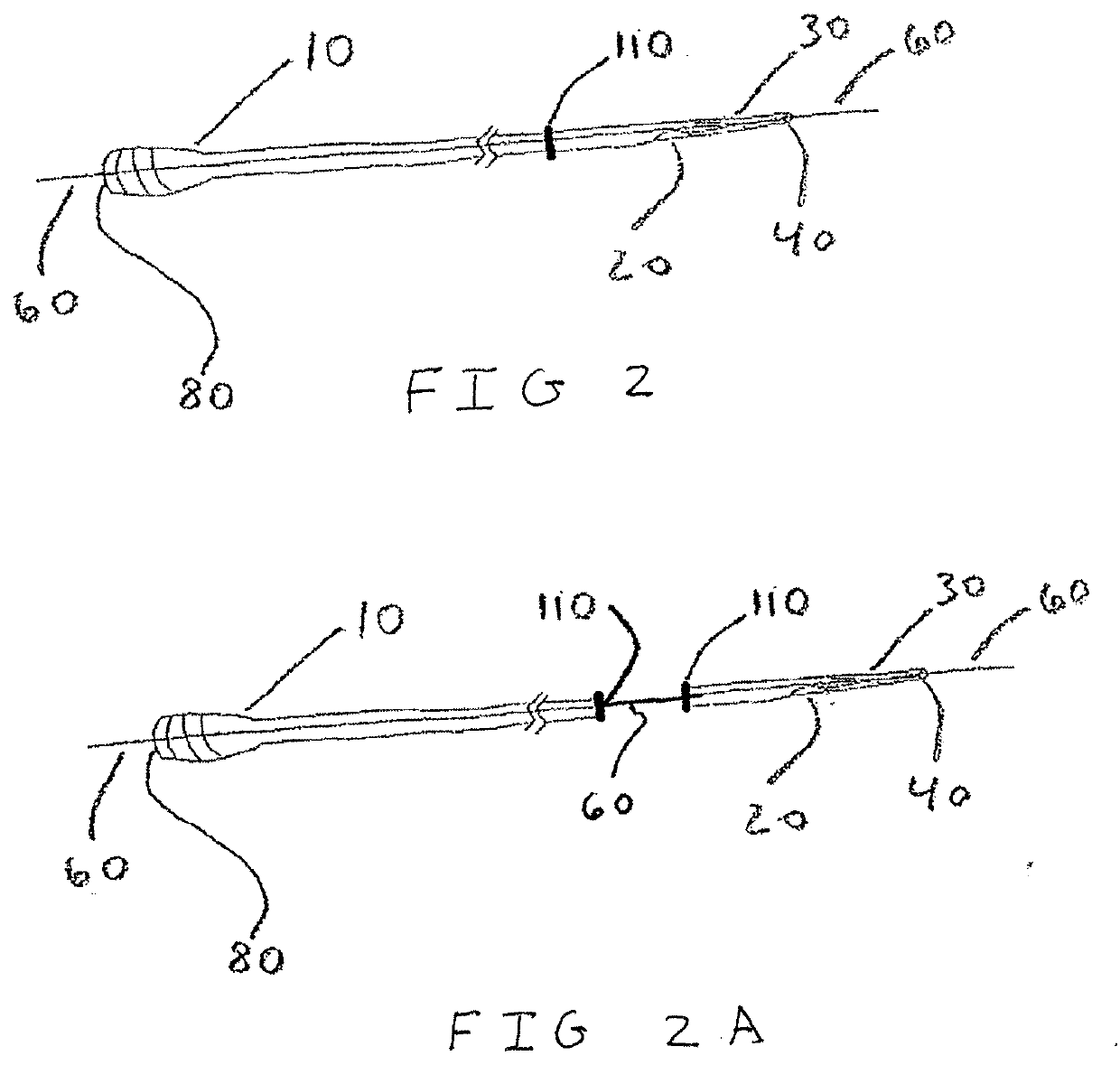 Single Lumen Microcatheter for Executing Plugs near Distal Terminus of Lumen