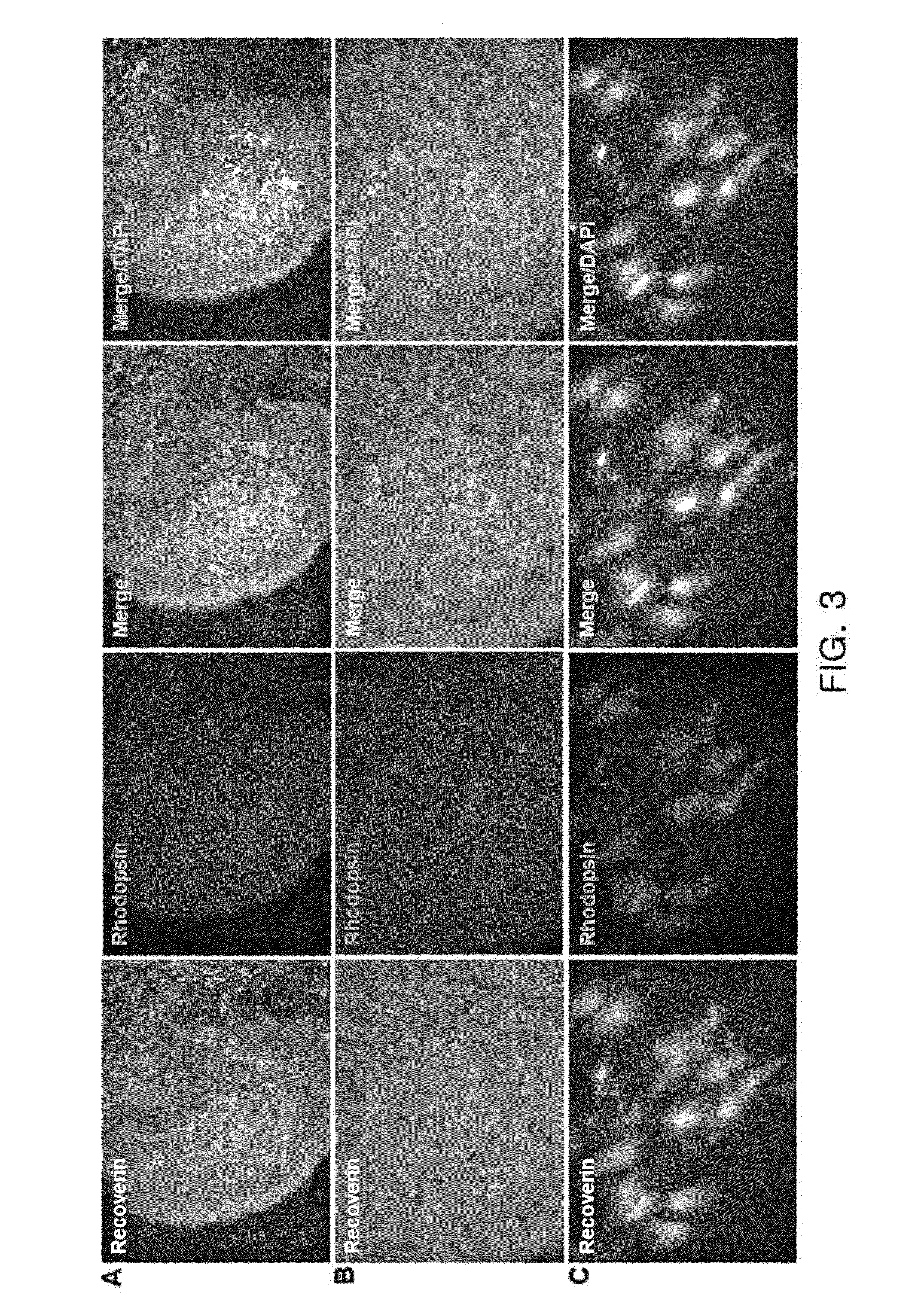 Compositions for inducing differentiation into retinal cells from retinal progenitor cells or inducing proliferation of retinal cells comprising Wnt signaling pathway activators
