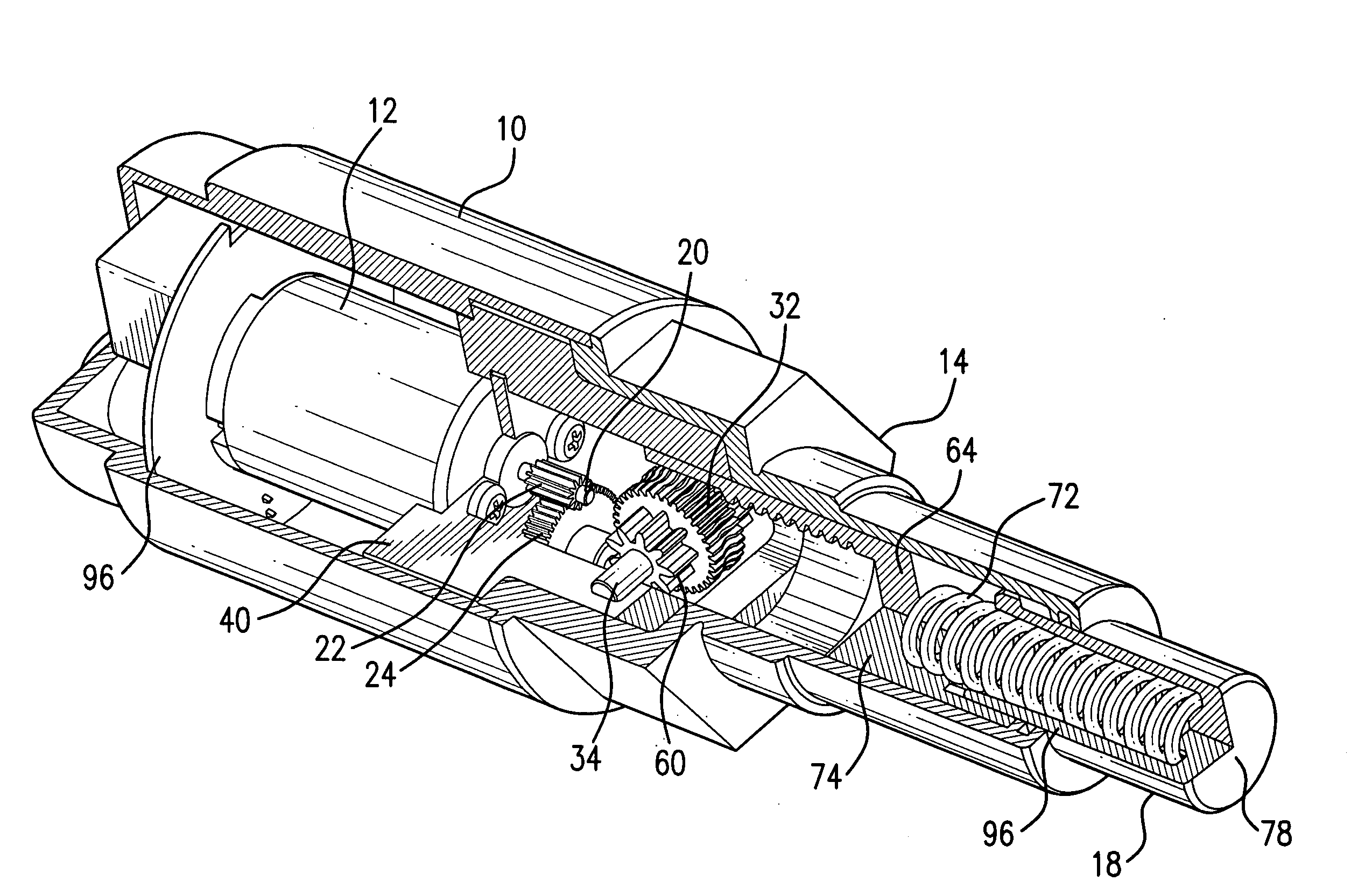 Motor-driven actuator