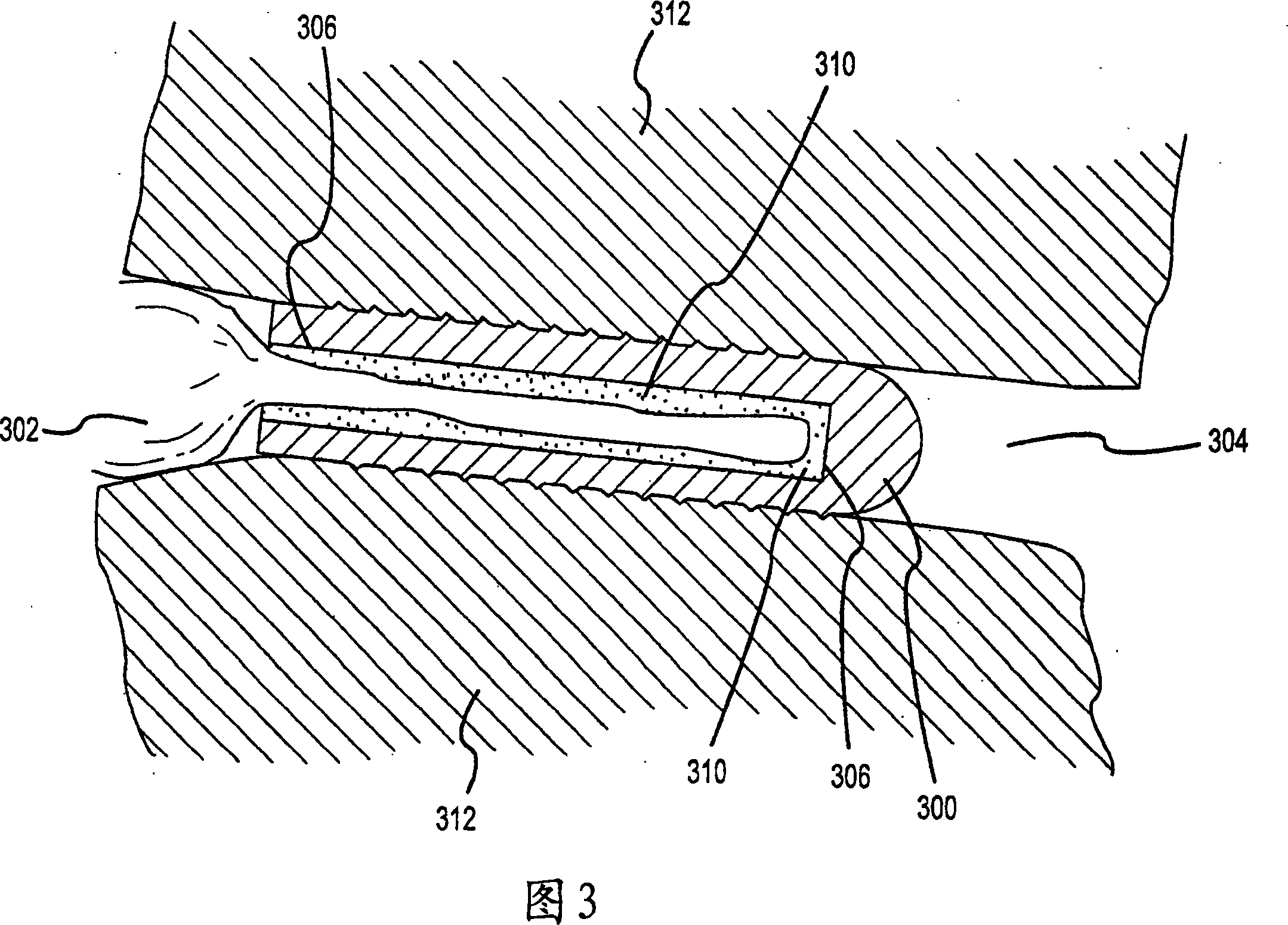 A graft fixation device and method