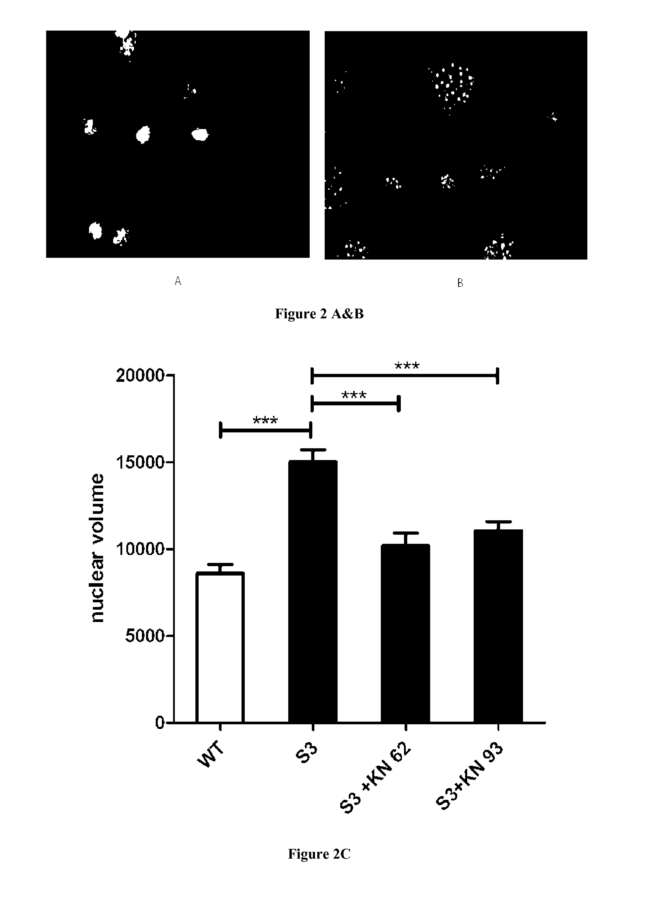 Methods and Pharmaceutical Compositions for the Treatment of X-Linked Charcot-Marie-Tooth
