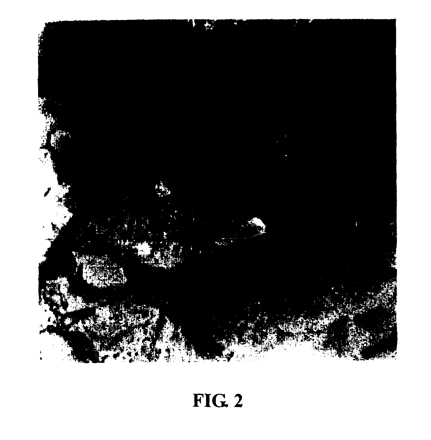 Medicament and method for treating recurrent spontaneous abortion