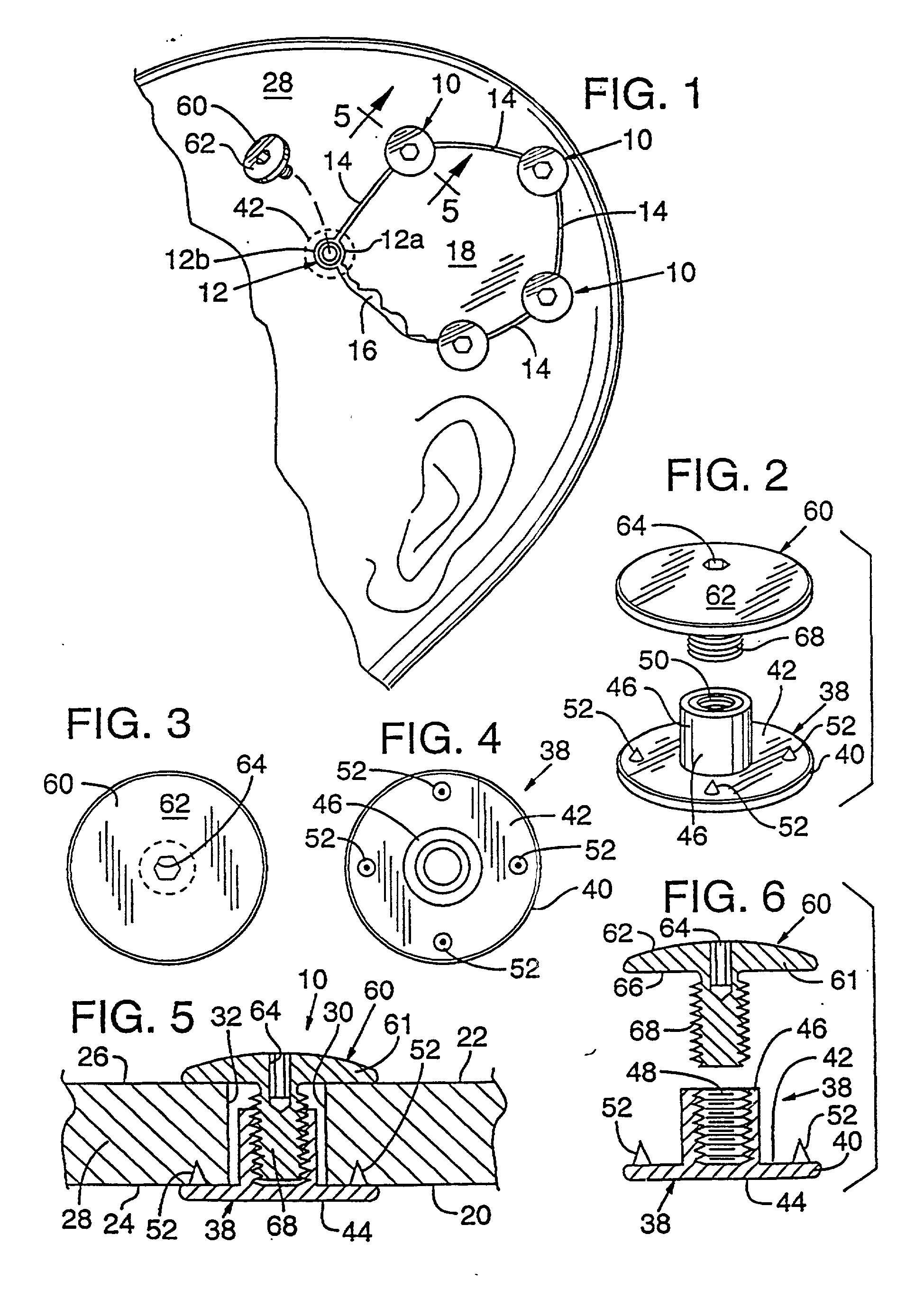 Bone fastener and instrument for insertion thereof