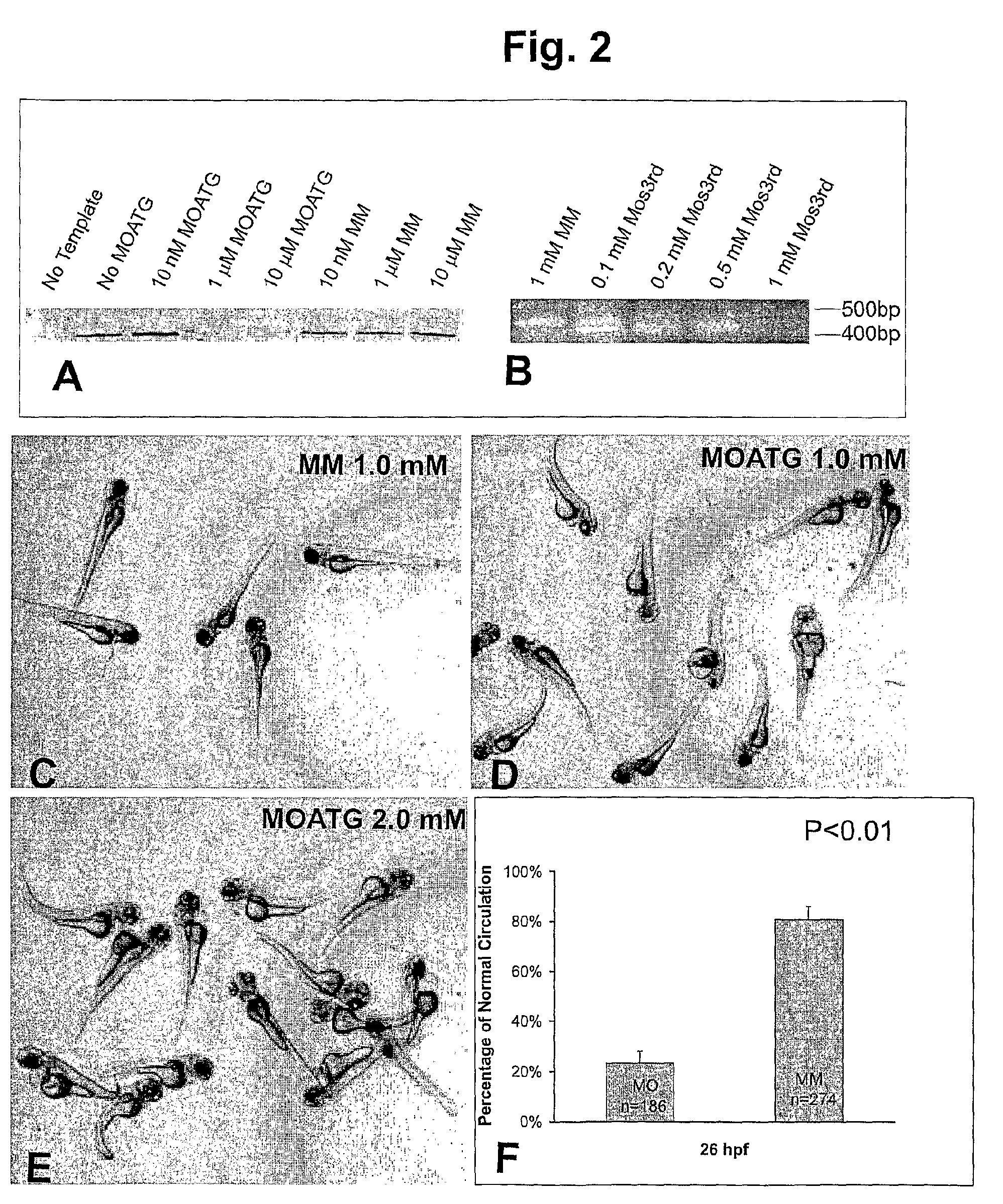 Methods and compositions for the treatment and diagnosis of endothelial cell disorders and angiogenic disorders