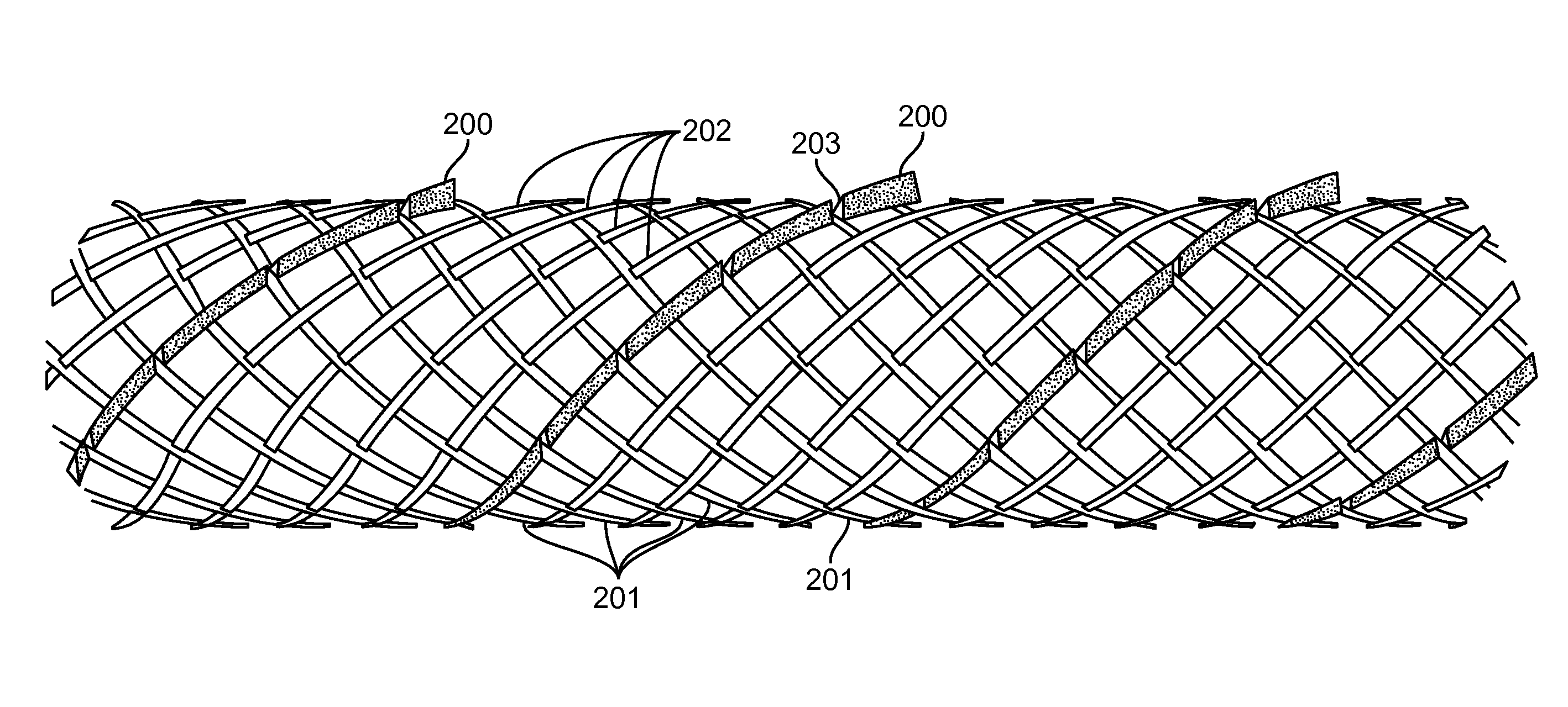 Temporary vascular scaffold and scoring device