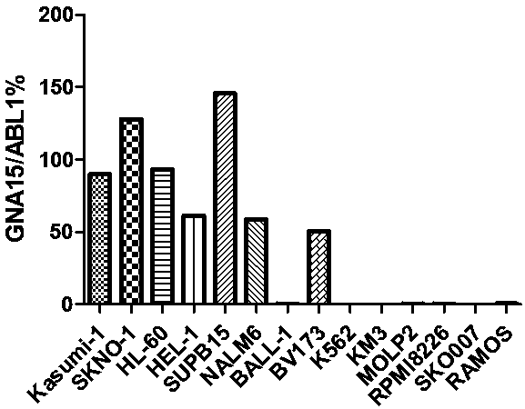 Primer probe set, kit and method for quantitatively detecting expression amount of GNA15 gene