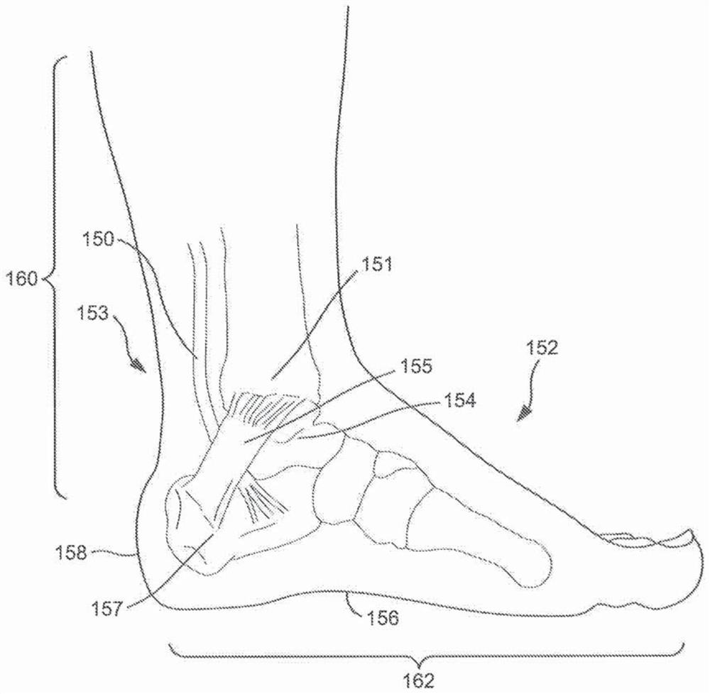 Methods and systems for monitoring and treating conditions via posterior tibial nerve stimulation