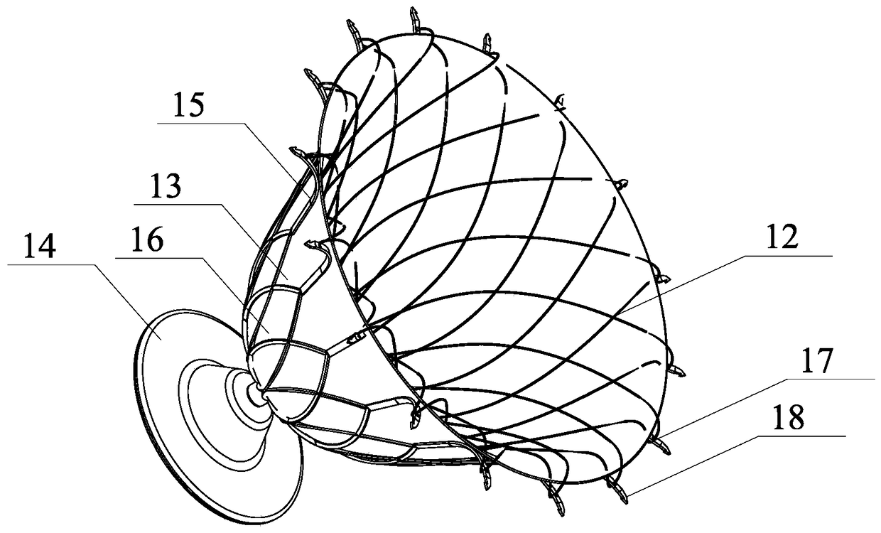 Left Ventricular Volume Reducing Device