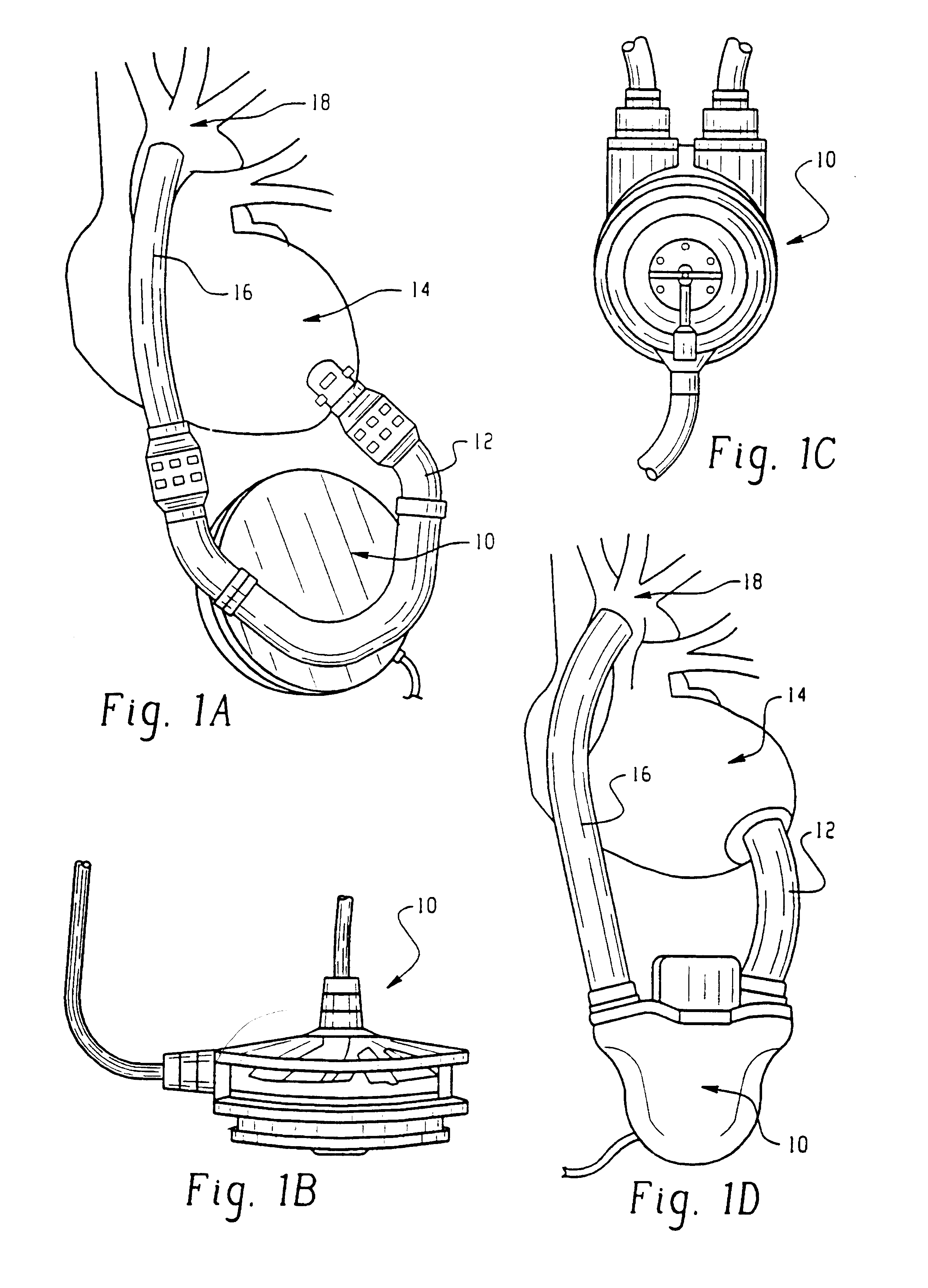 System for incorporating sonomicrometer functions into medical instruments and implantable biomedical devices