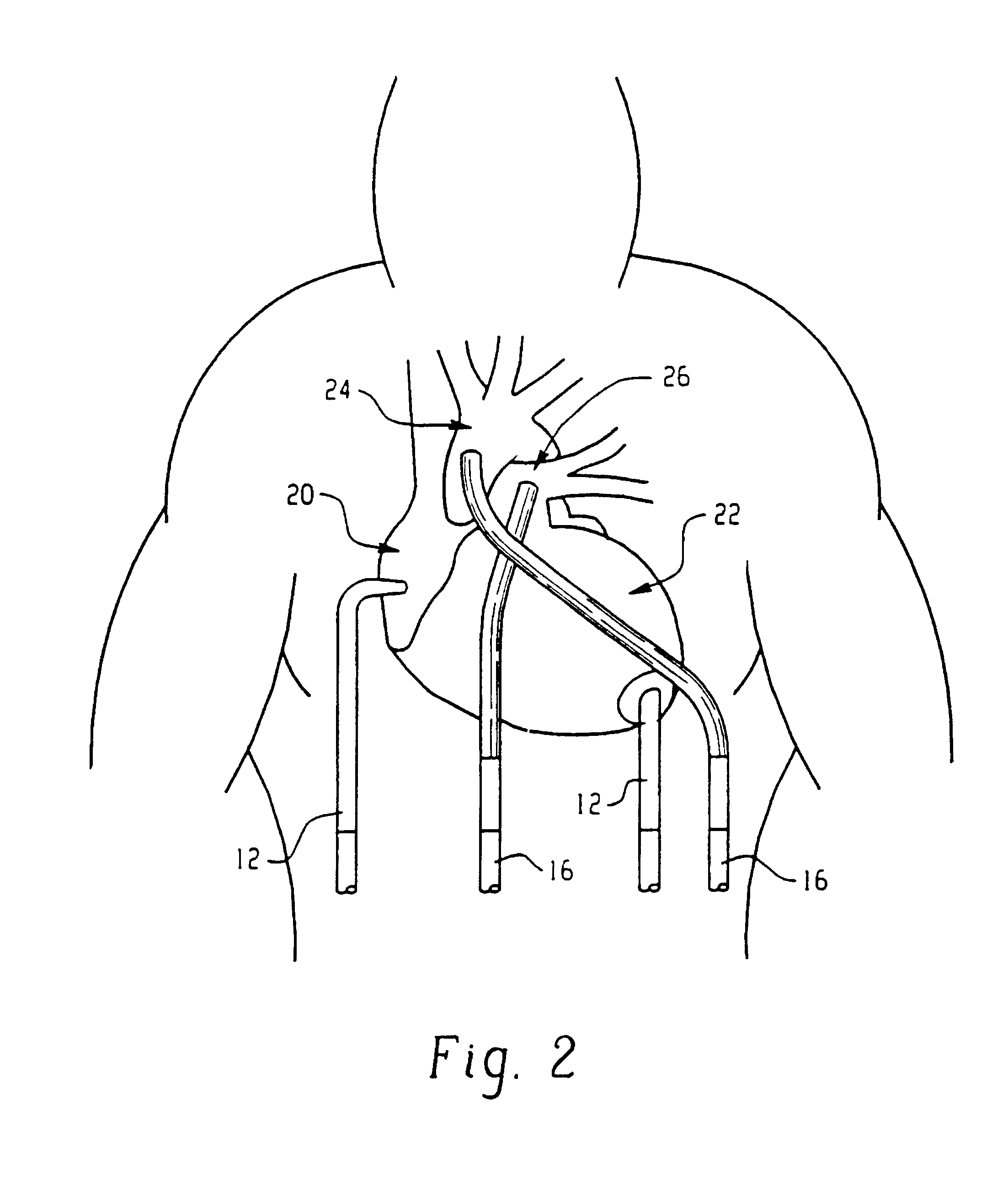 System for incorporating sonomicrometer functions into medical instruments and implantable biomedical devices