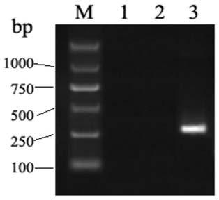 Breast cancer gene ERBB2 locus g.39711928A) G mutant and application thereof