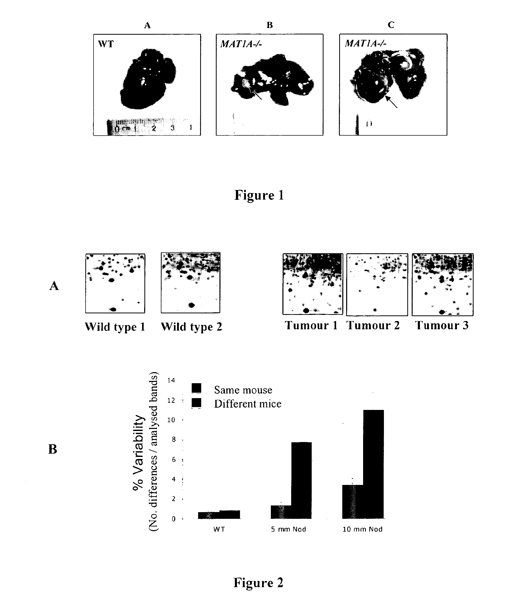 Molecular markers of hepatocellular carcinoma and their applications