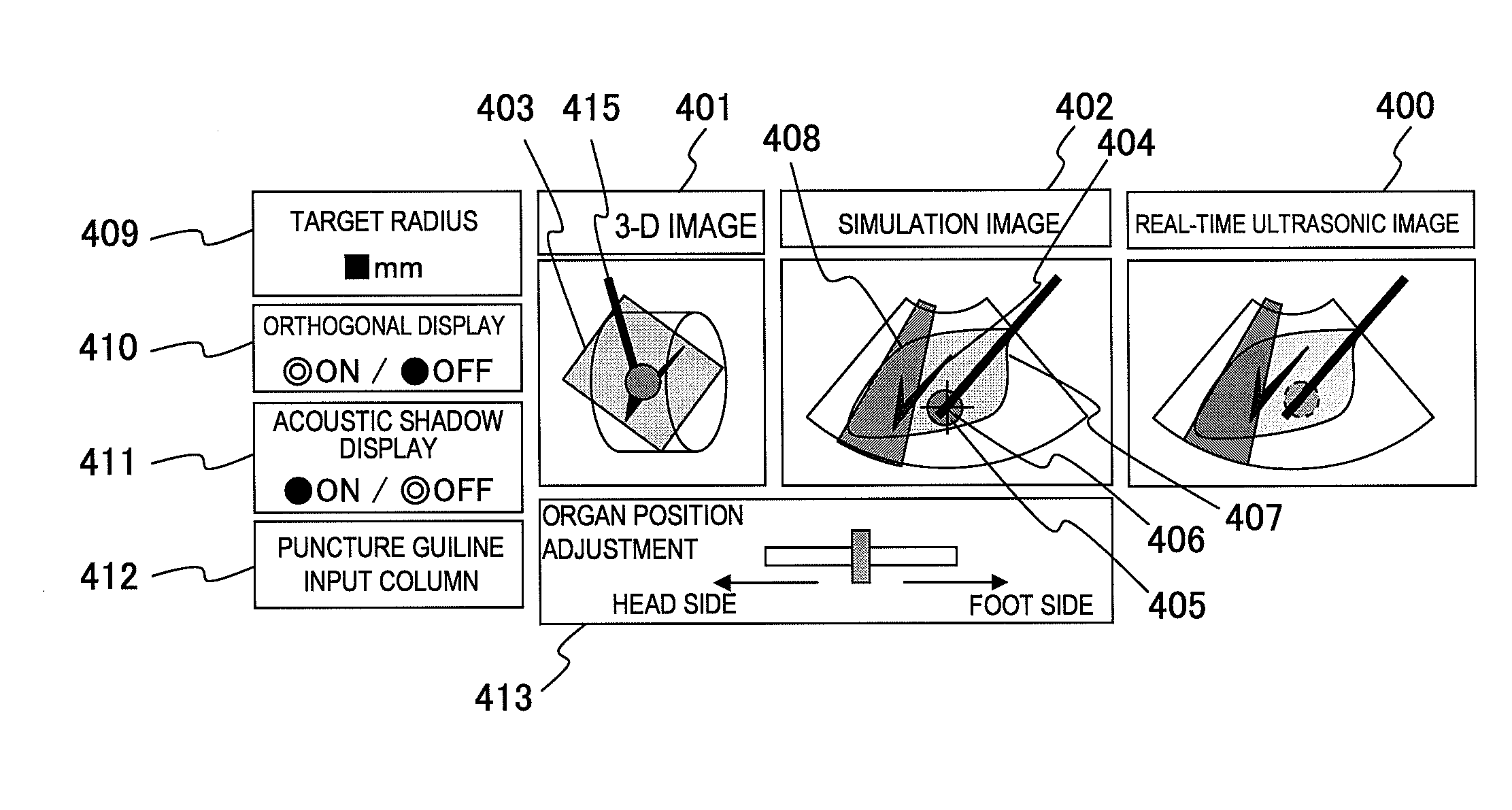 Puncture Treatment Supporting Apparatus