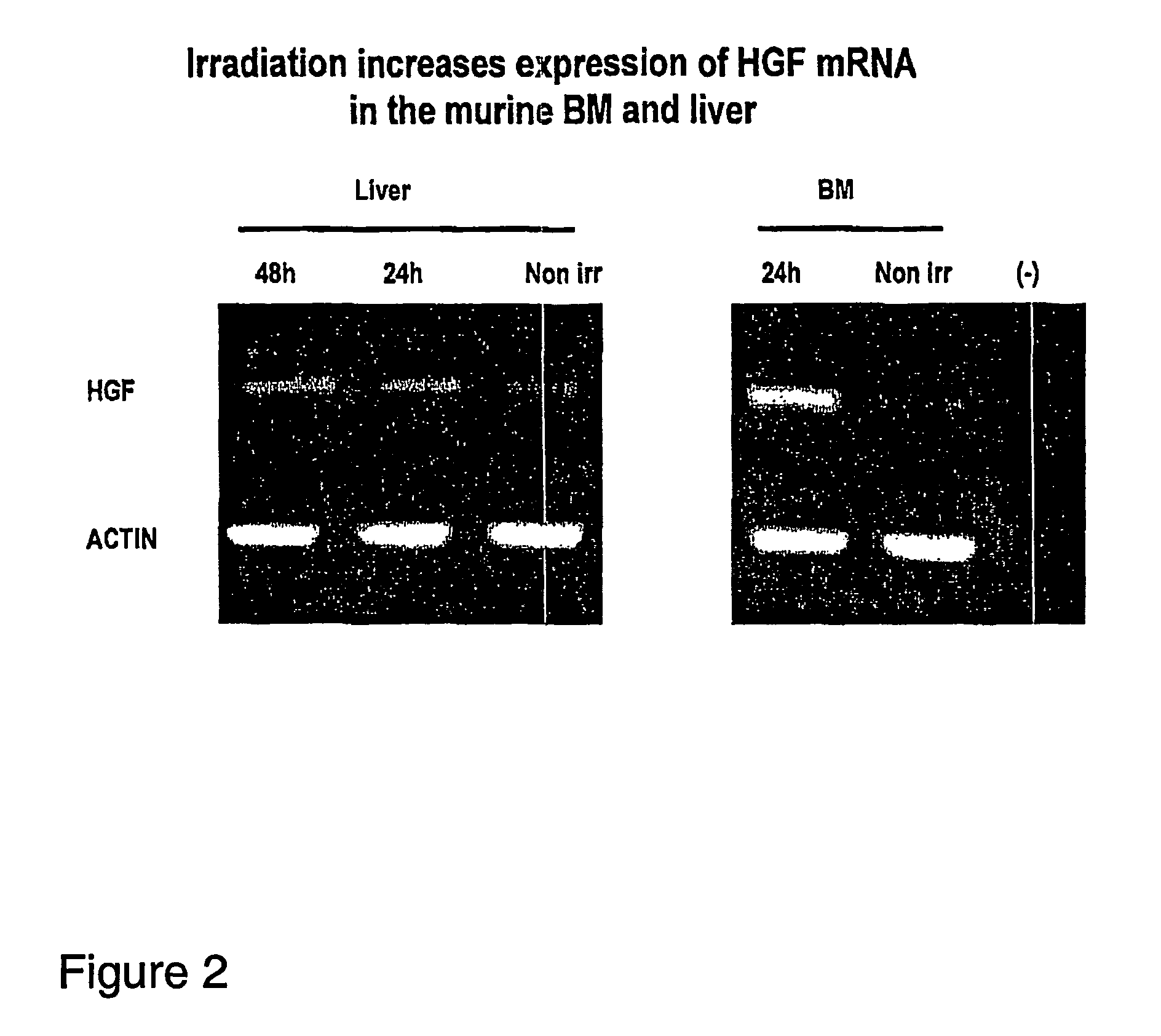 Stem cells having increased sensitivity to a chemoattractant and methods of generating and using same