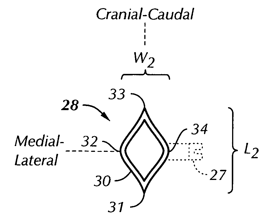 Working channel for minimally invasive spine surgery