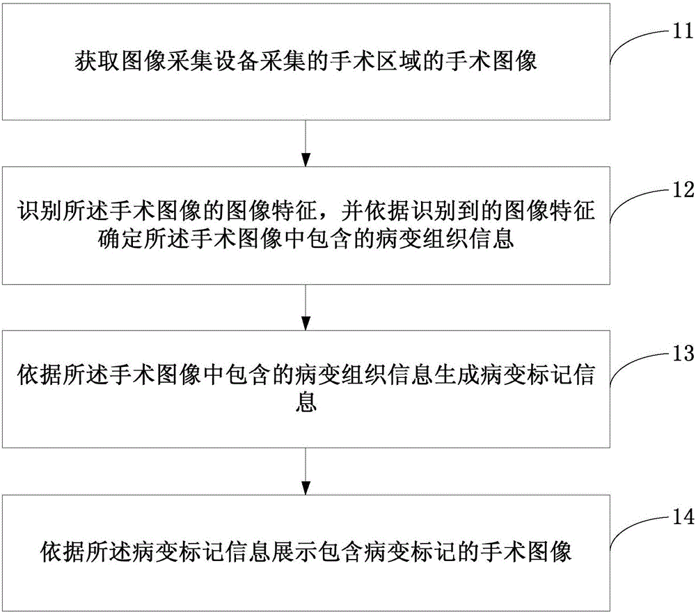 Surgery image processing method and surgery image processing device