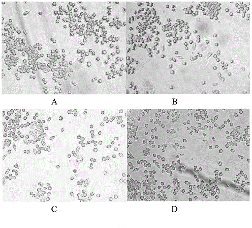 Reactive-oxygen-species sensitive nanoparticle capable of promoting vascularization of surface of wound and preparation method thereof
