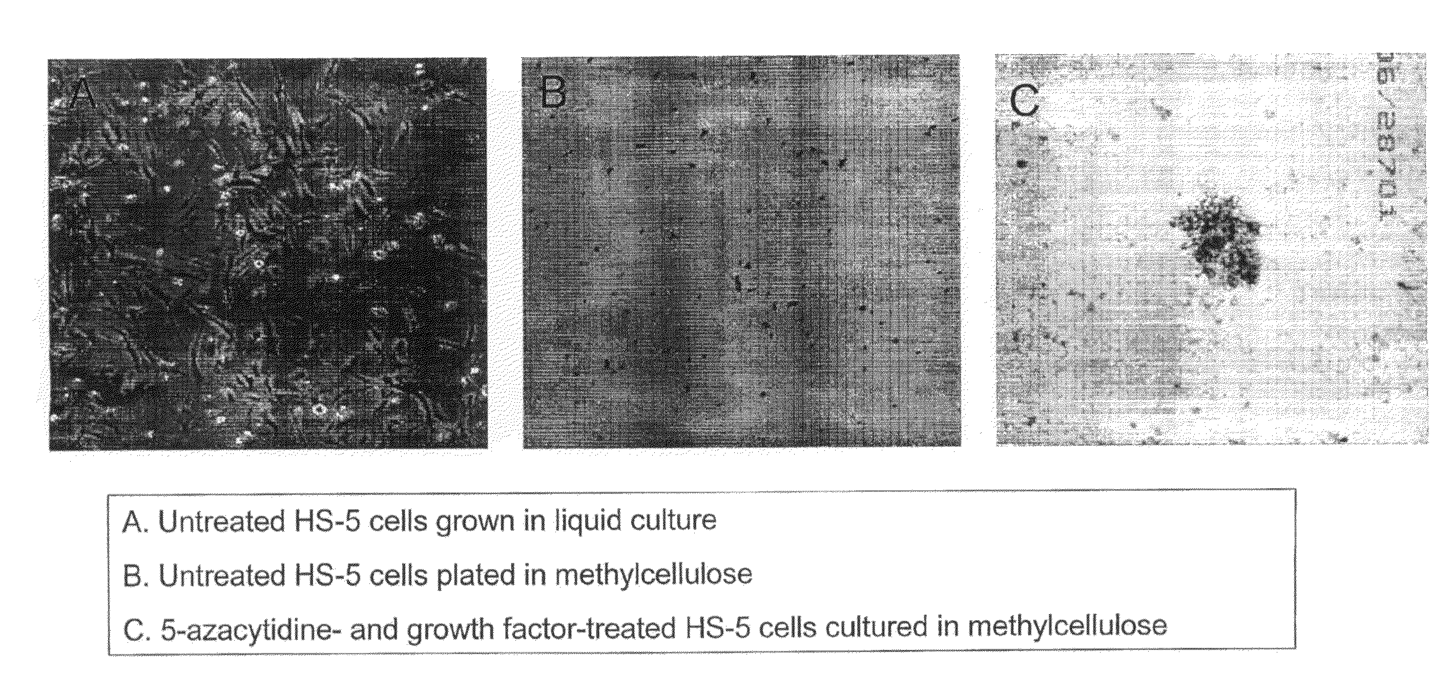 Methods for trans-differentiating cells