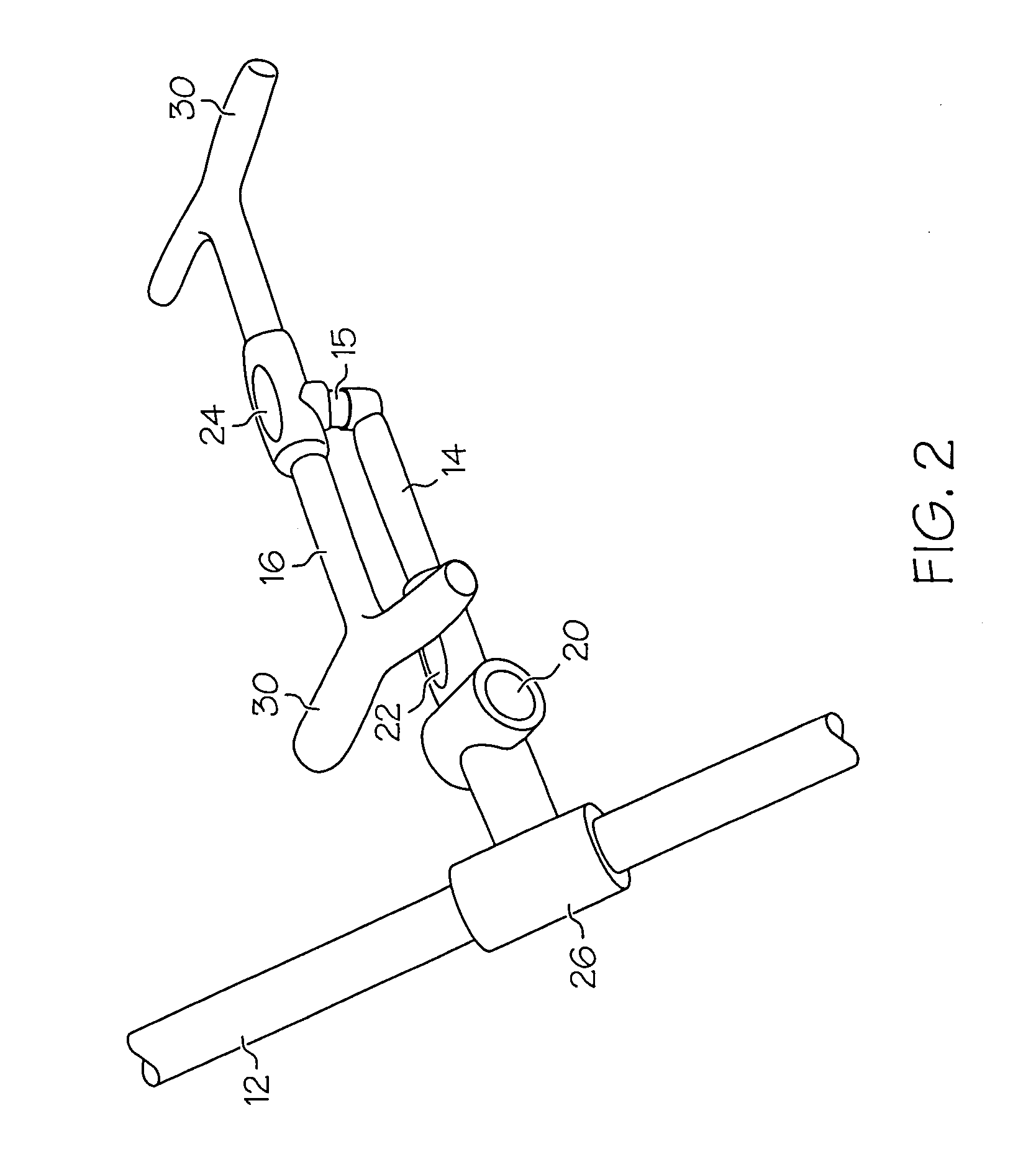 Assist apparatus and method