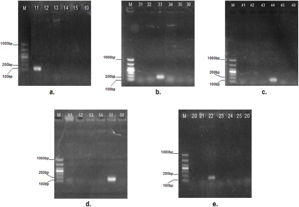 PCR (Polymerase Chain Reaction) primer group for distinguishing five types of shellfish bait microalgae