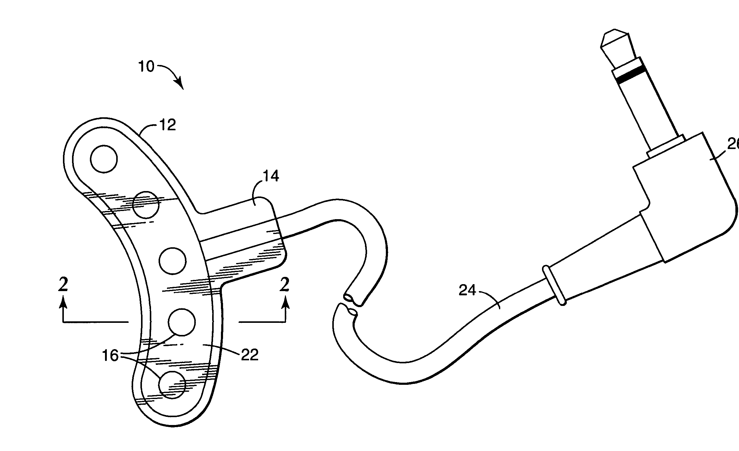 Method and apparatus for bonding orthodontic appliances to teeth