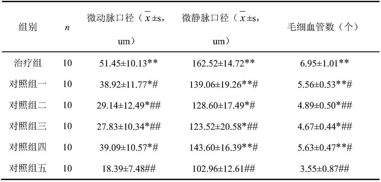 External use traditional Chinese medicine composition for treating myofascitis, and preparation method and application thereof