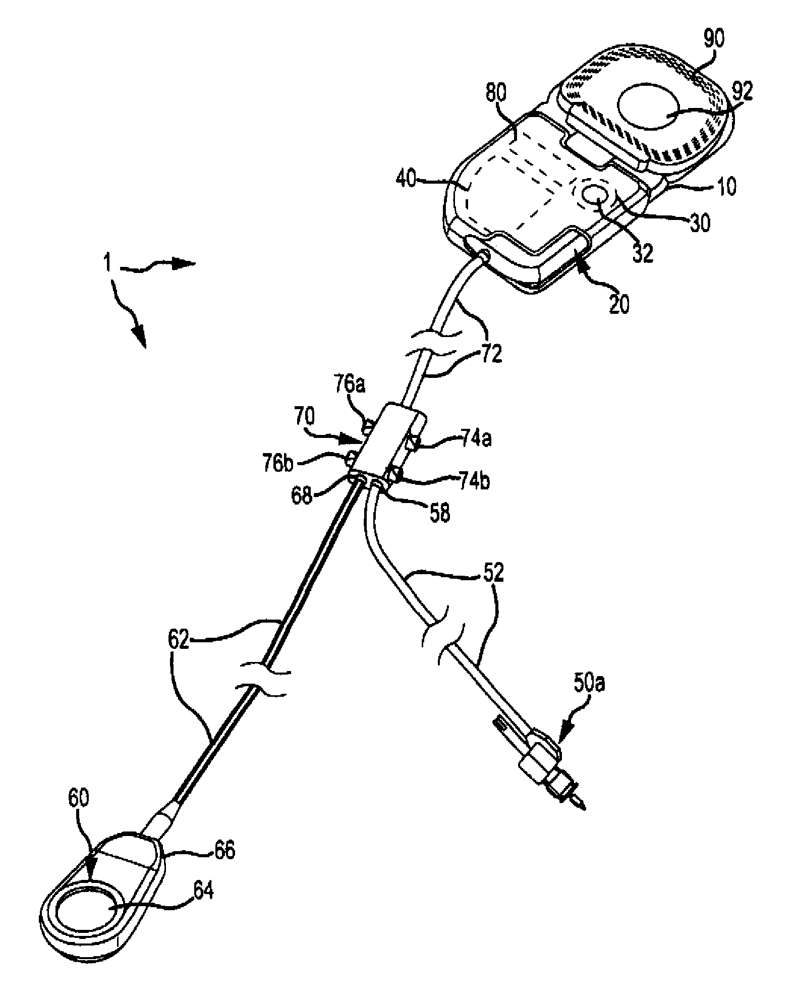 Implantable auditory stimulation system and method with offset implanted microphones