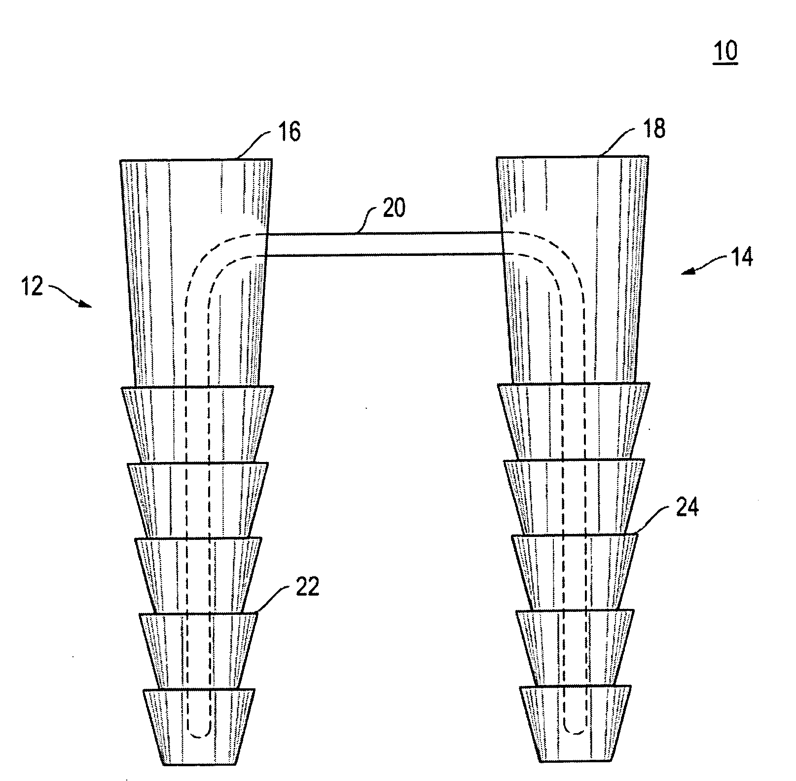 Kit Containing Combination Absorbable Staple and Non-absorbable Suture, And Method Of Using Same