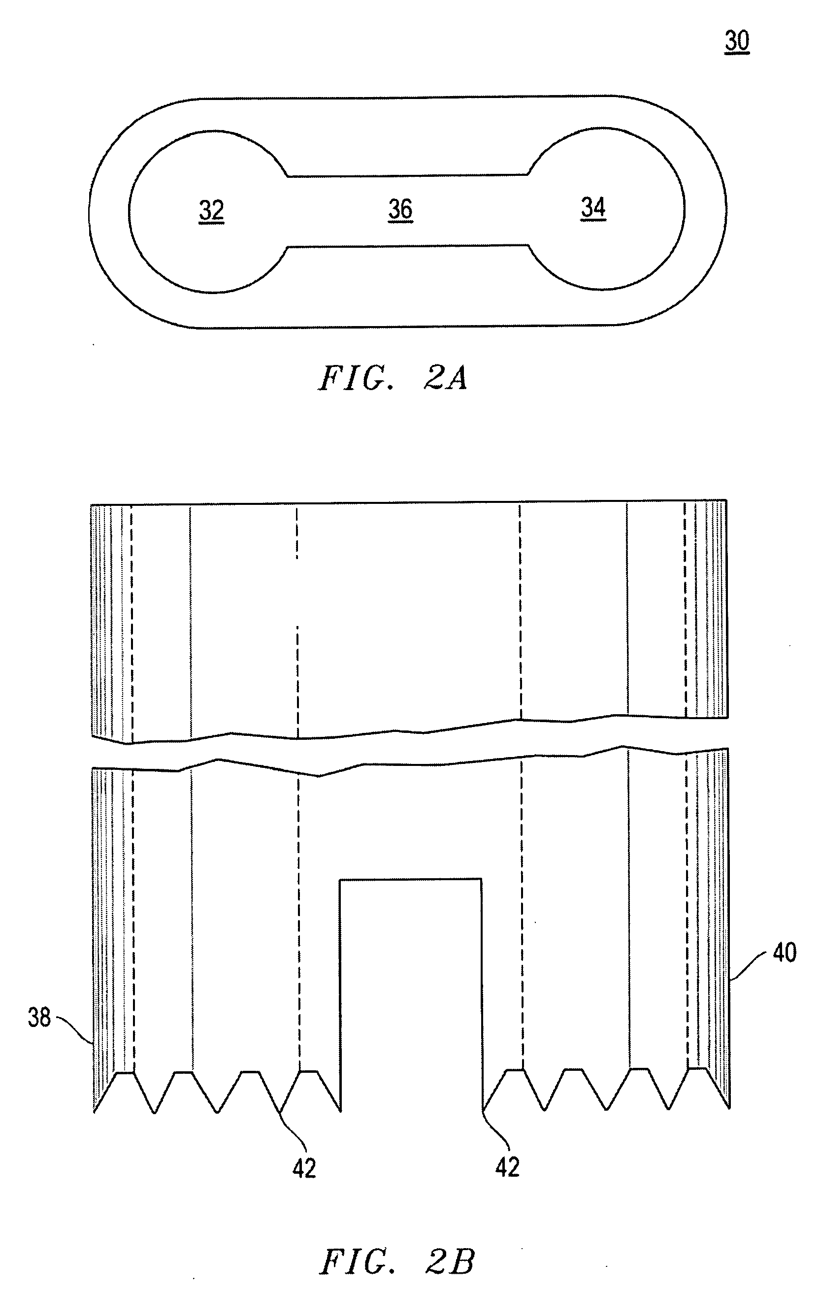 Kit Containing Combination Absorbable Staple and Non-absorbable Suture, And Method Of Using Same