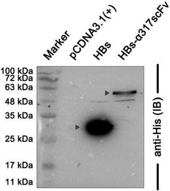 HBs-[alpha]317ScFv recombinant protein, and coding sequence, expression carrier, and applications thereof