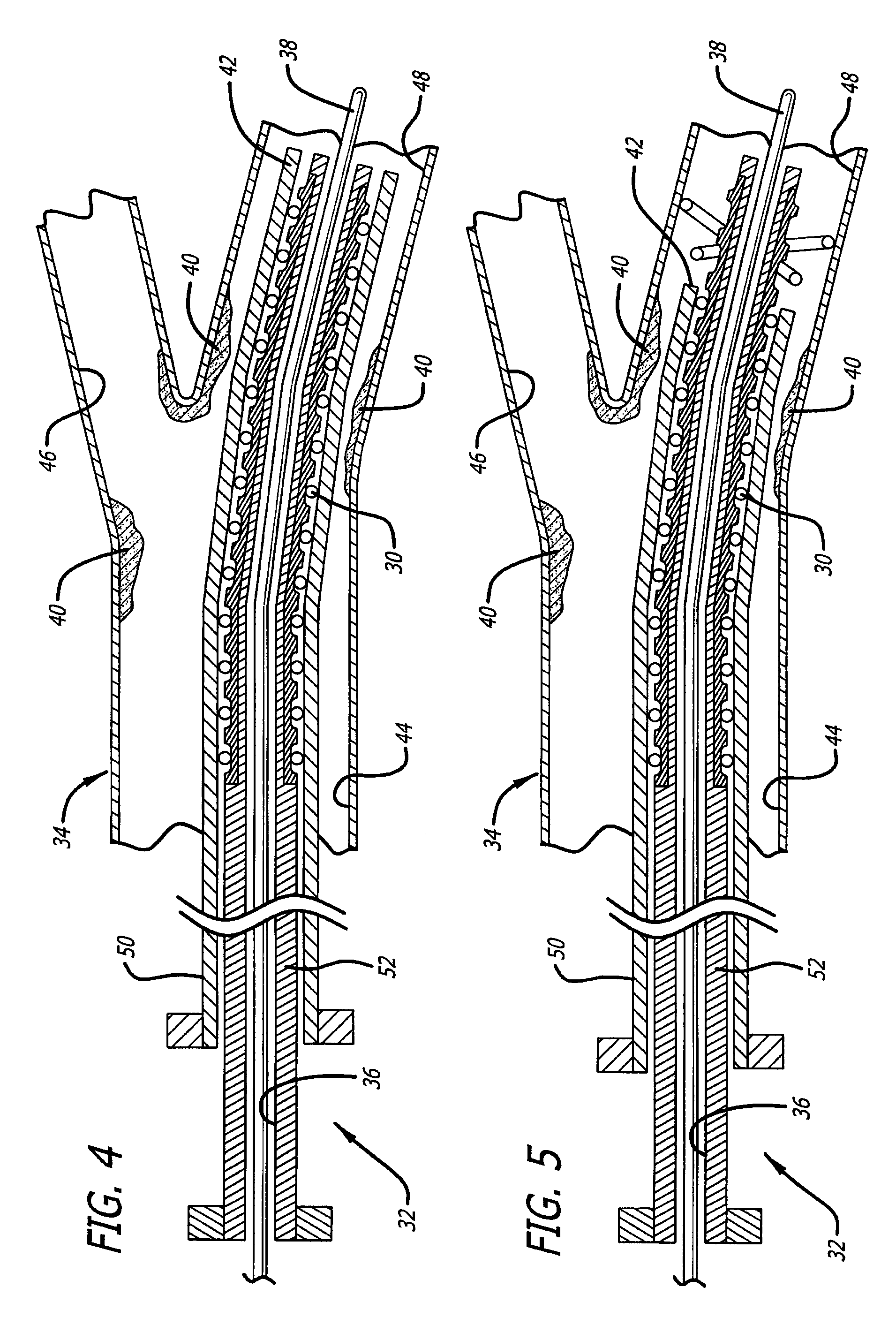 Variable stiffness medical devices