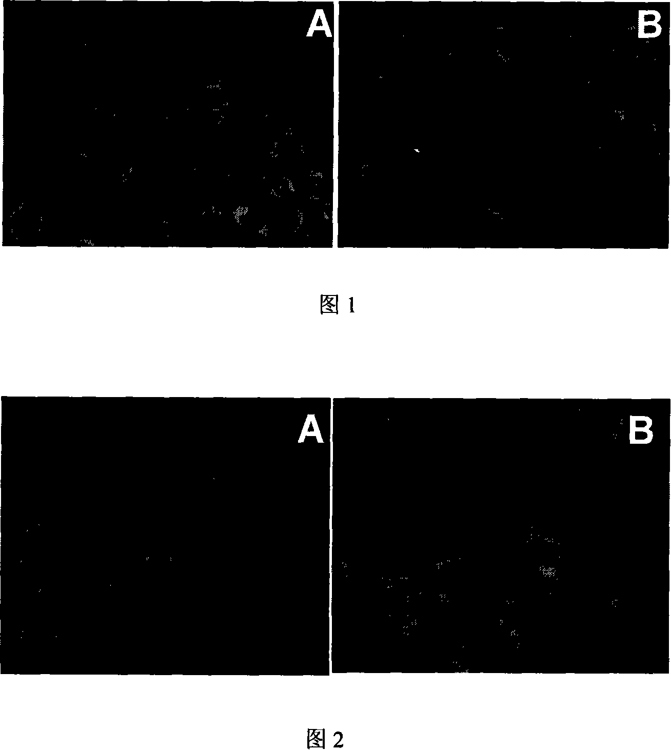 Use of nano structured lipid carrier drug feeding system