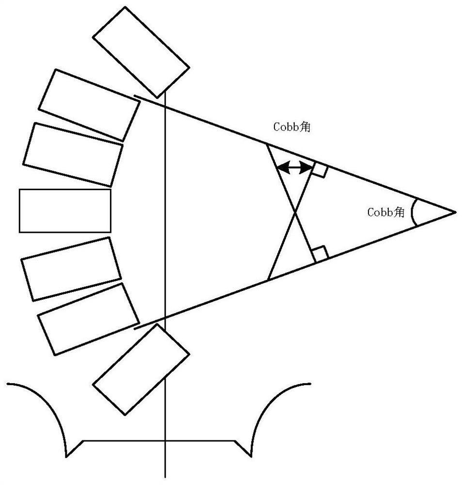 Scoliosis prediction method and device, electronic equipment and storage medium