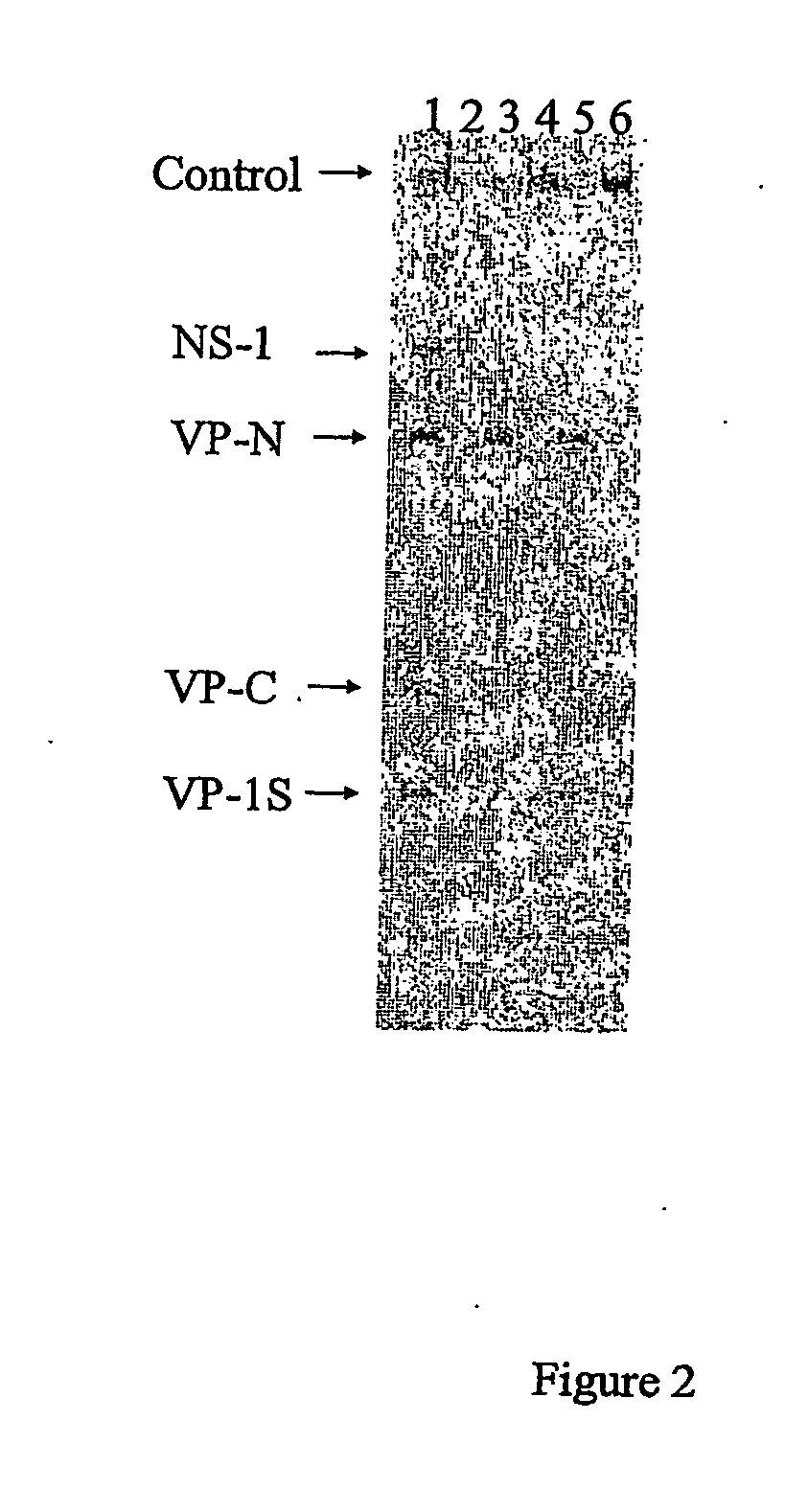 Methods for detecting parvovirous infections