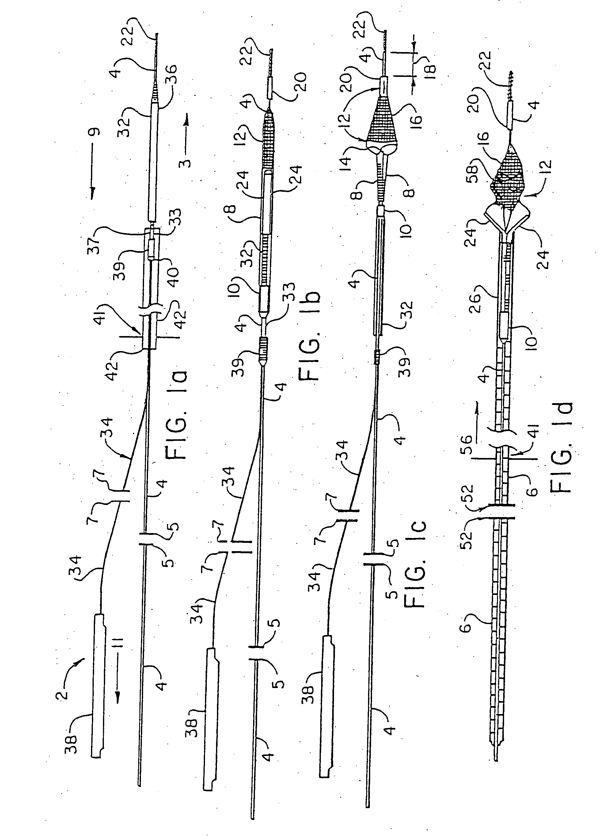 Apparatus for capturing objects beyond an operative site utilizing a capture device delivered on a medical guide wire