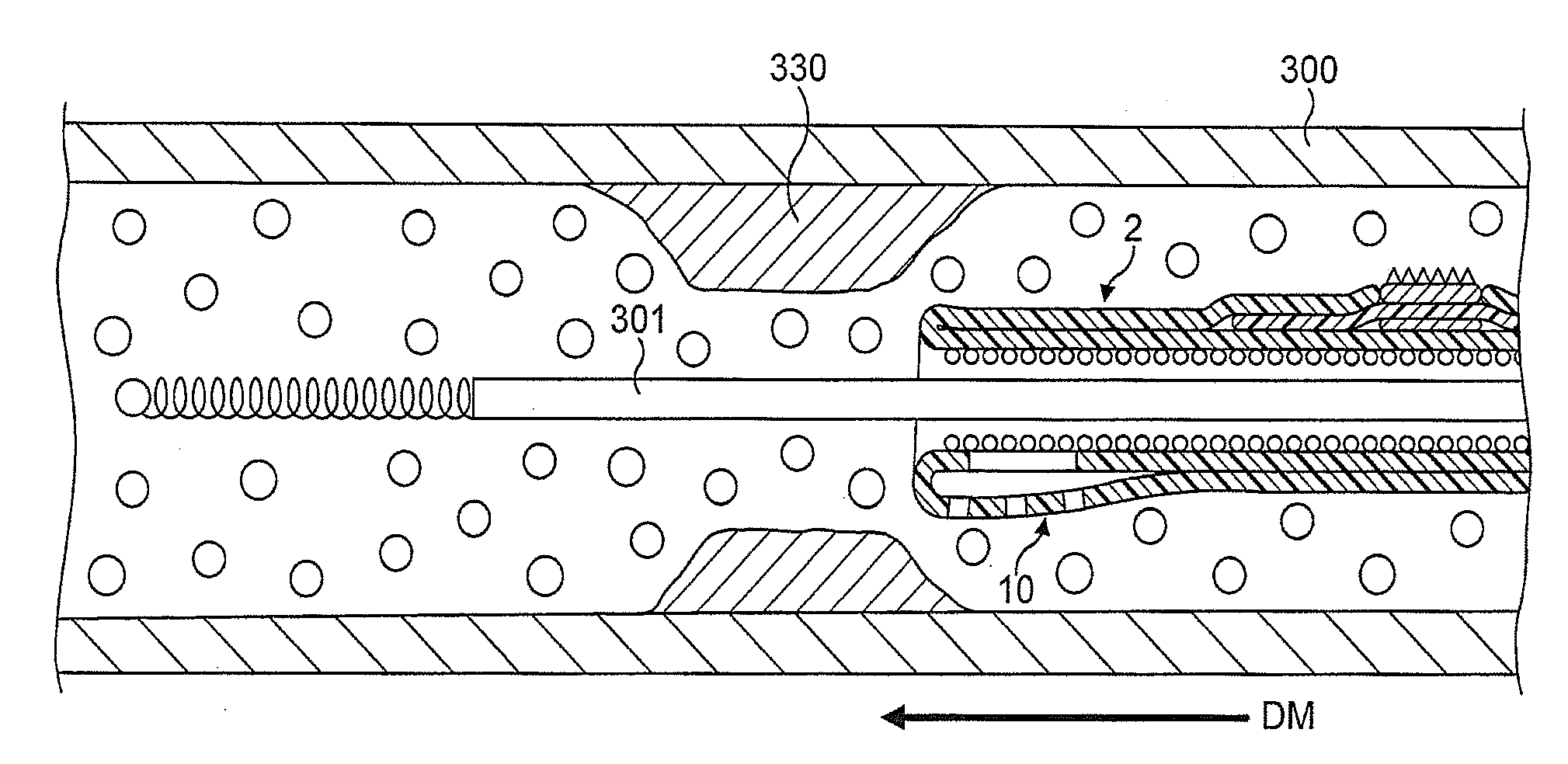 Rotational Atherectomy Device with Fluid Inflatable Support Elements and Two Torque Transmitting Coils