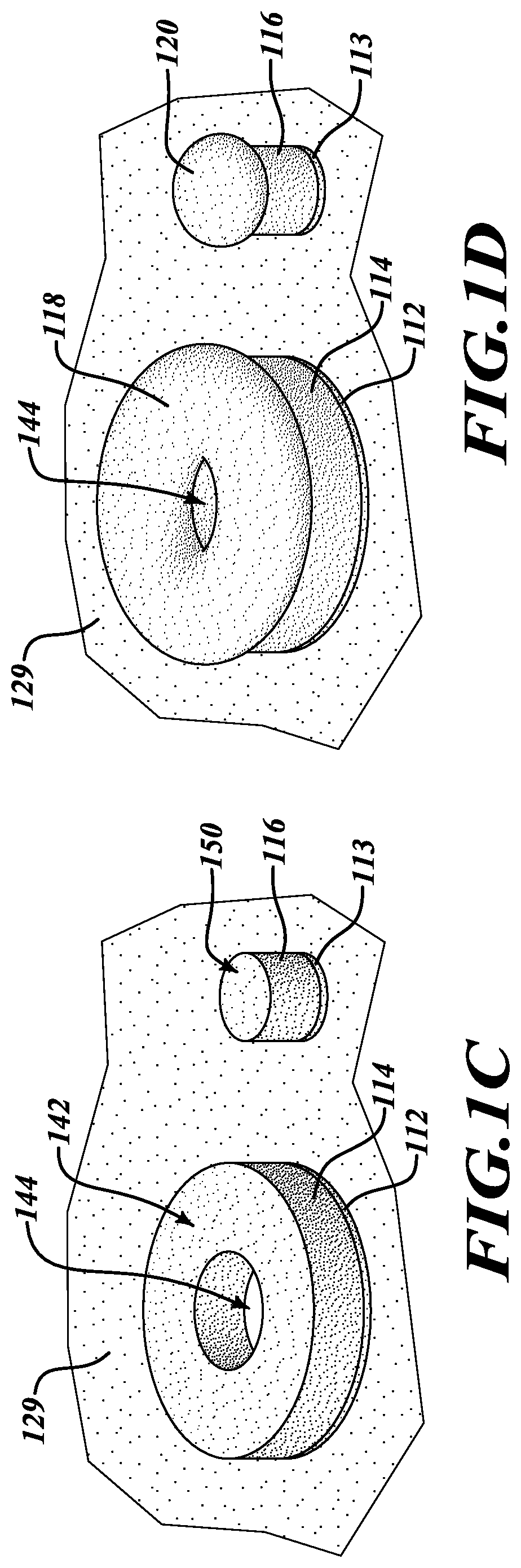 Coplanar bump contacts of differing sizes