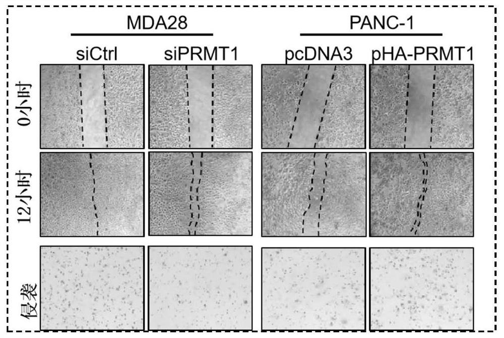 Drug for treating cancer