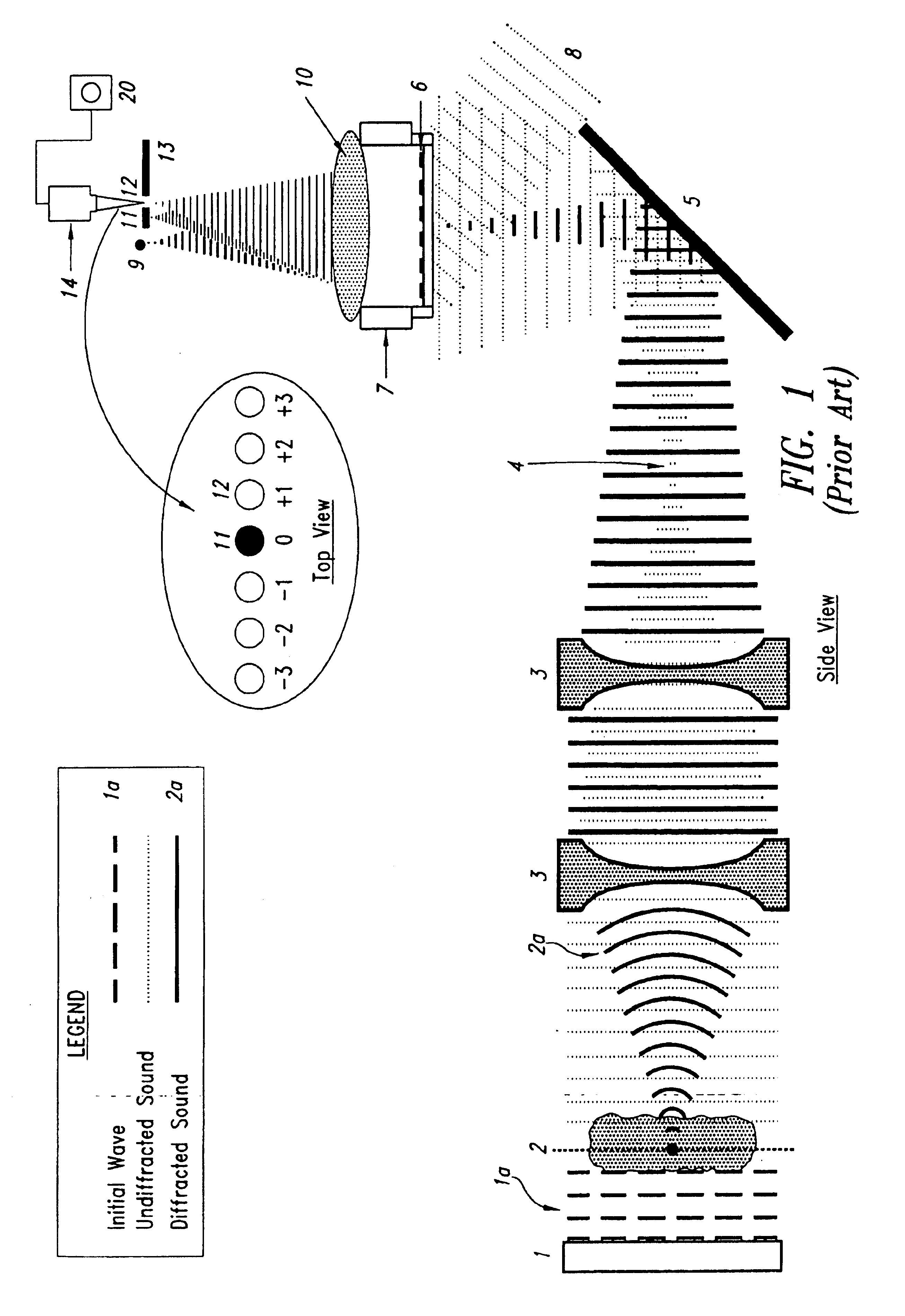 System and method for tissue biopsy using ultrasonic imaging