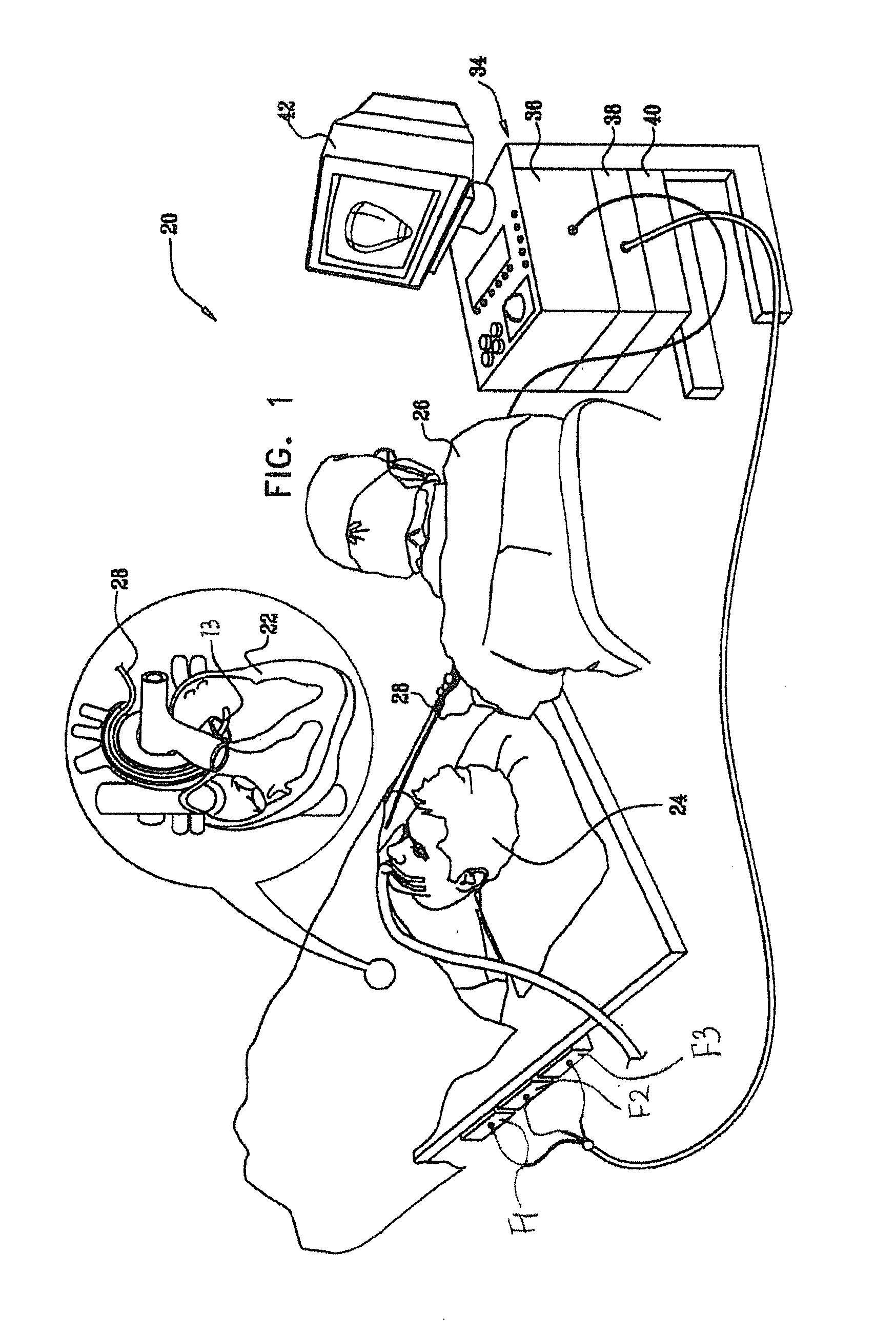 Catheter with combined position and pressure sensing structures