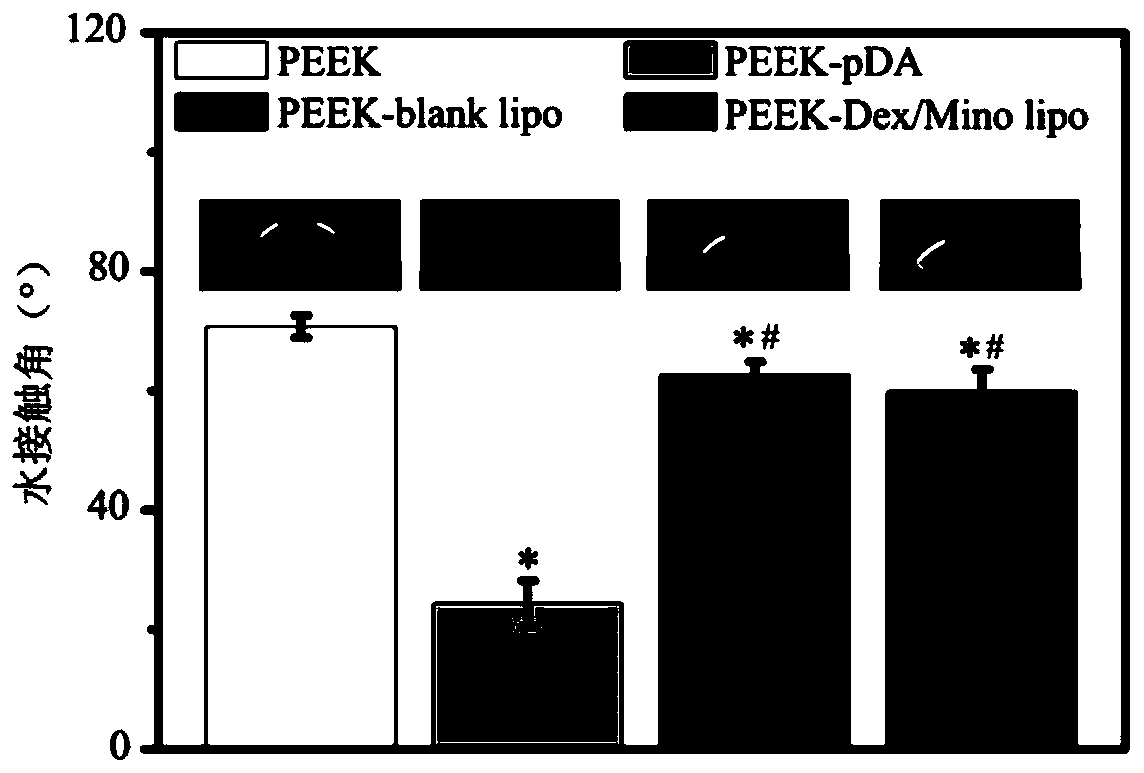 Lipidosome-based method for modifying PEEK (polyetheretherketone) surface with hexadecadrol/minocycline and application