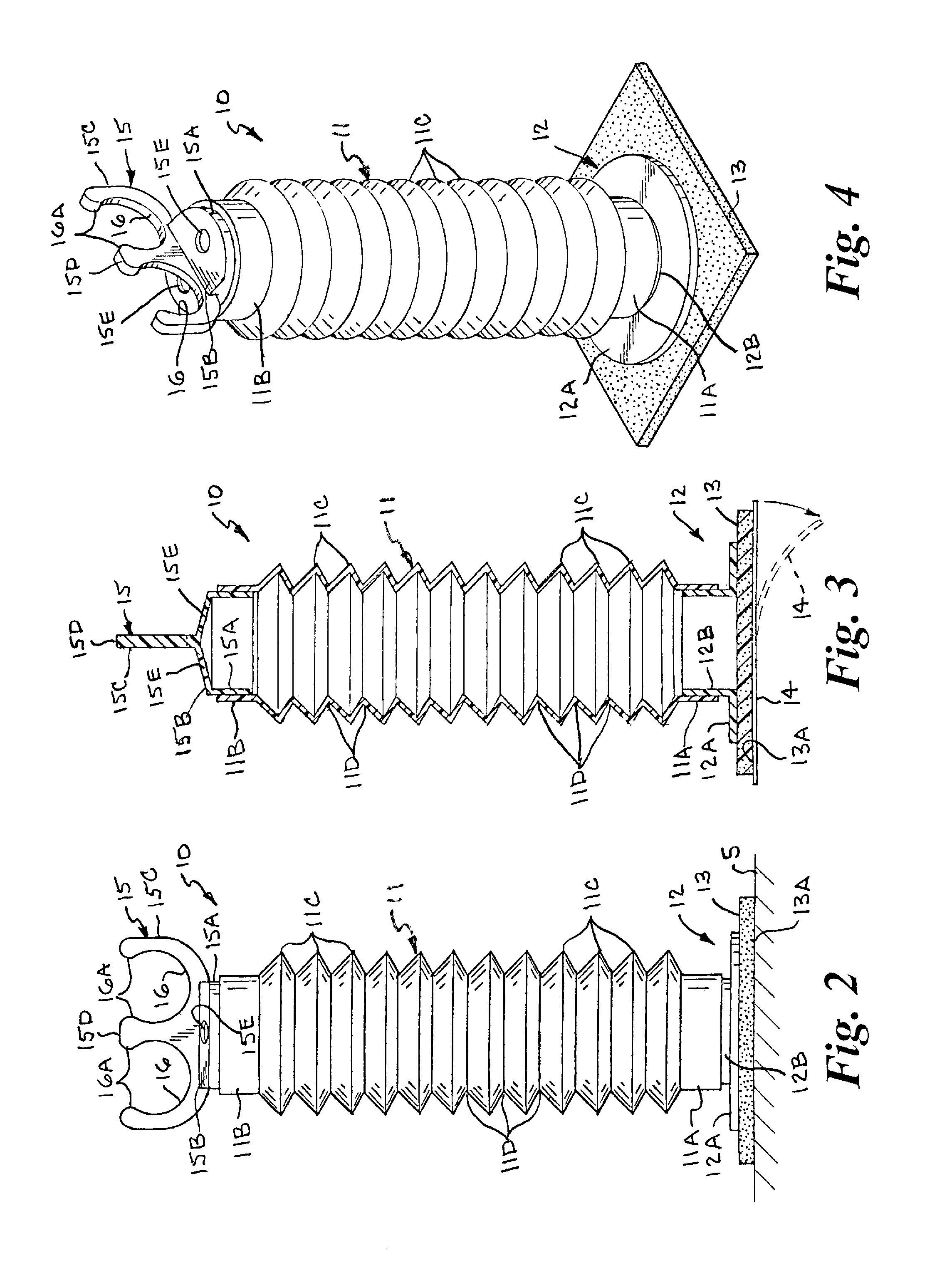Anesthesia breathing circuit tube support